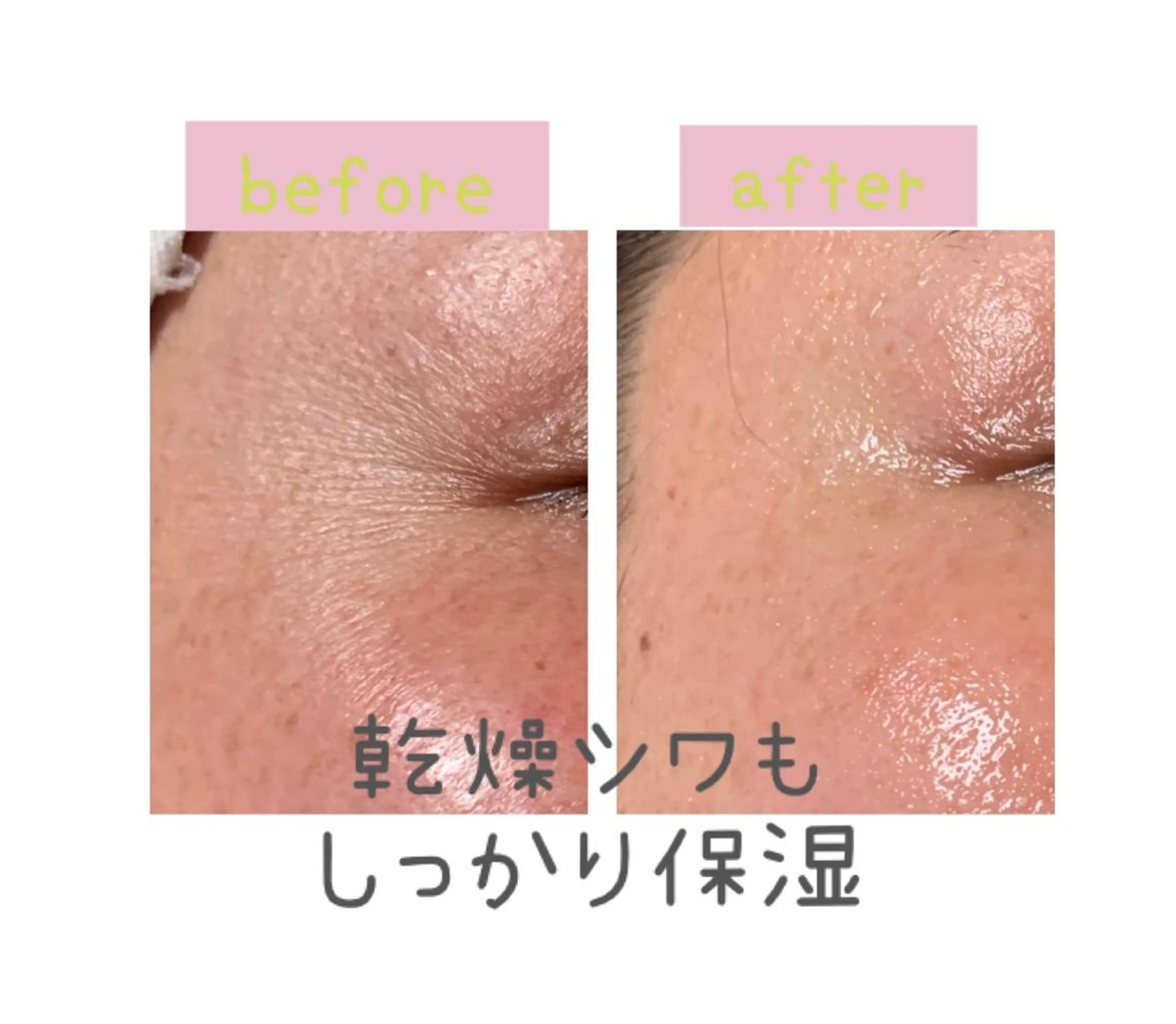 癒し腸もみサロン シャユーム　ゆきなのエステ・リラクイメージ