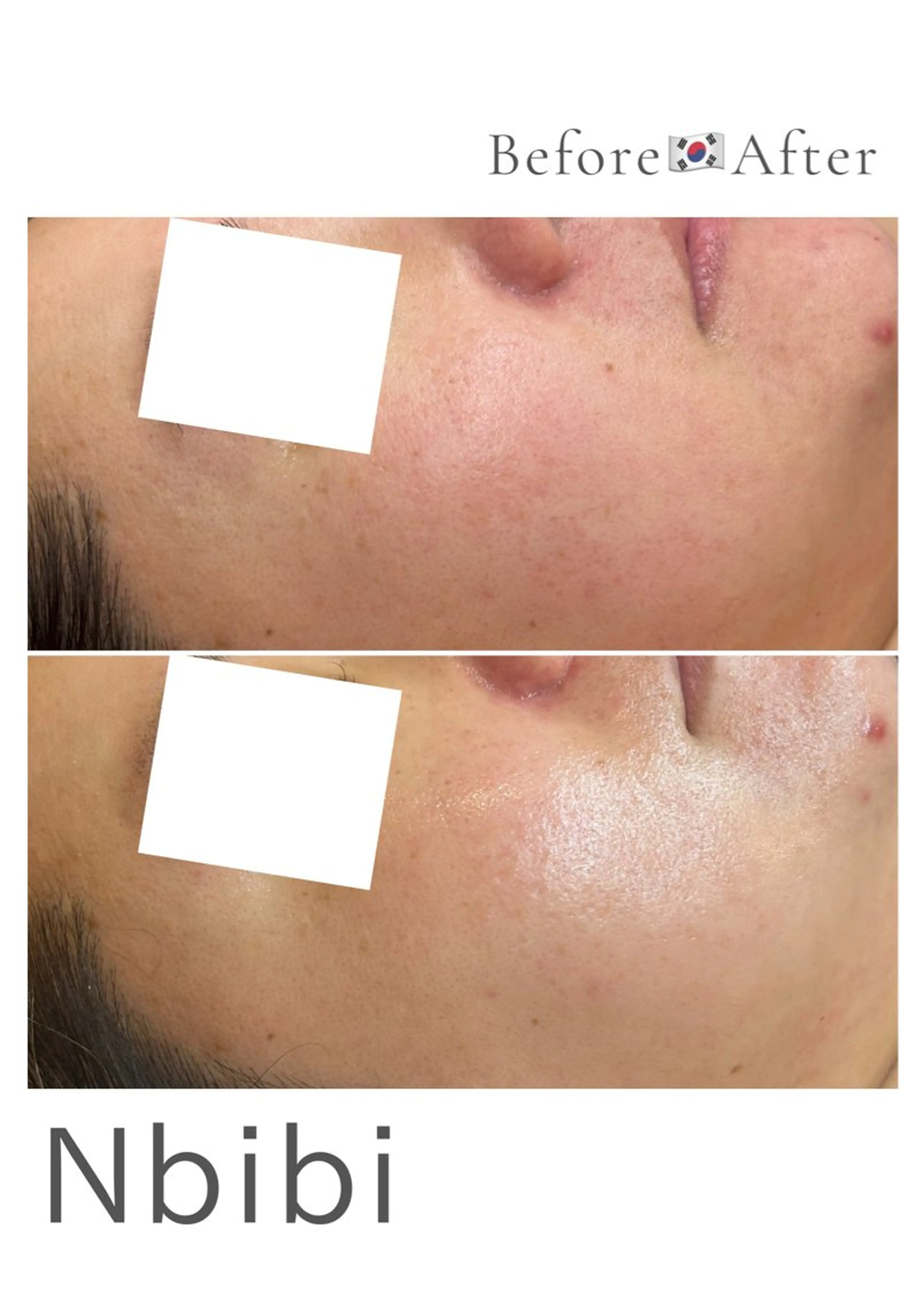 韓国🇰🇷価格 サロン_Nbibiのエステ・リラクイメージ