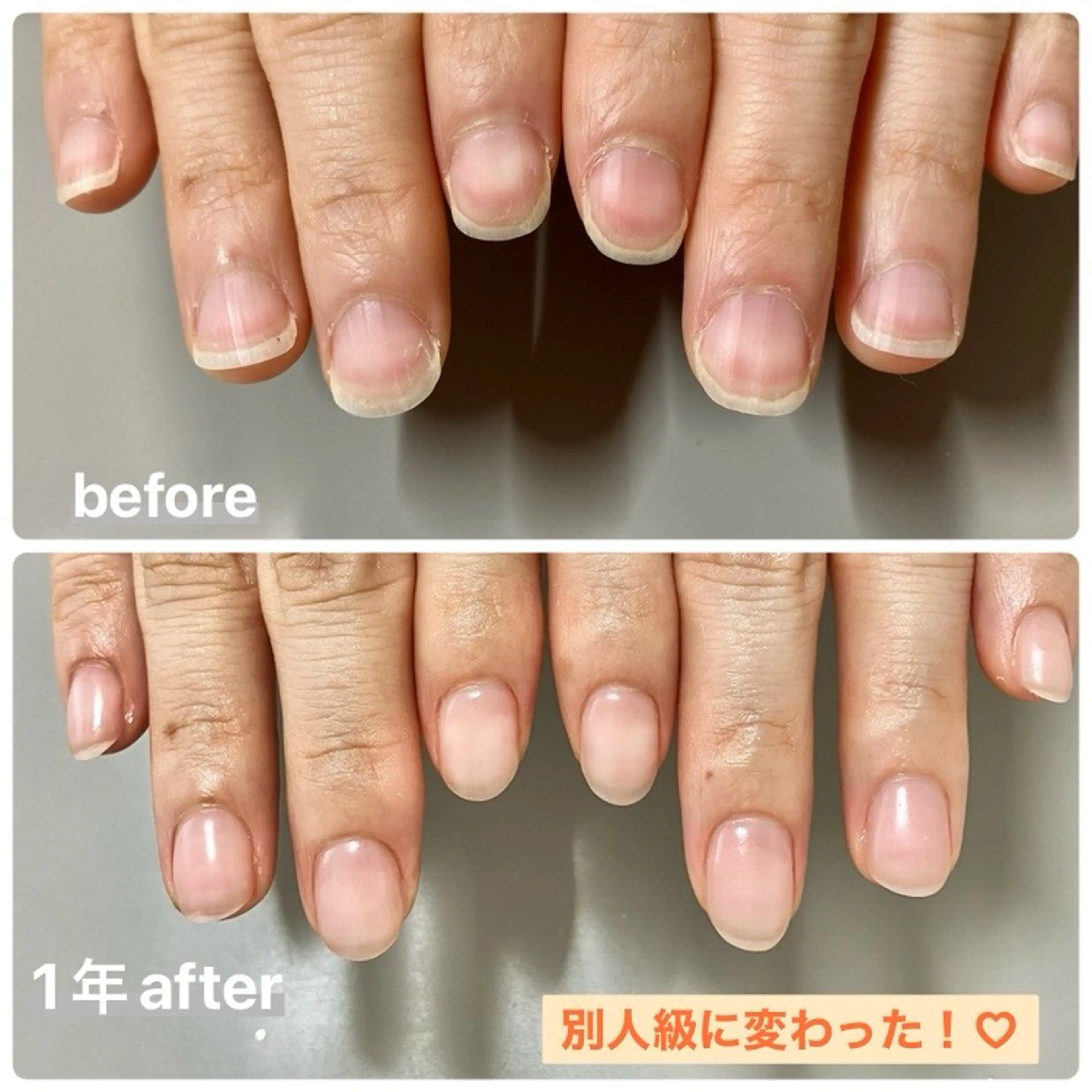 ネイル 京都桂/フィルイン /自爪育成/三品のネイルデザイン