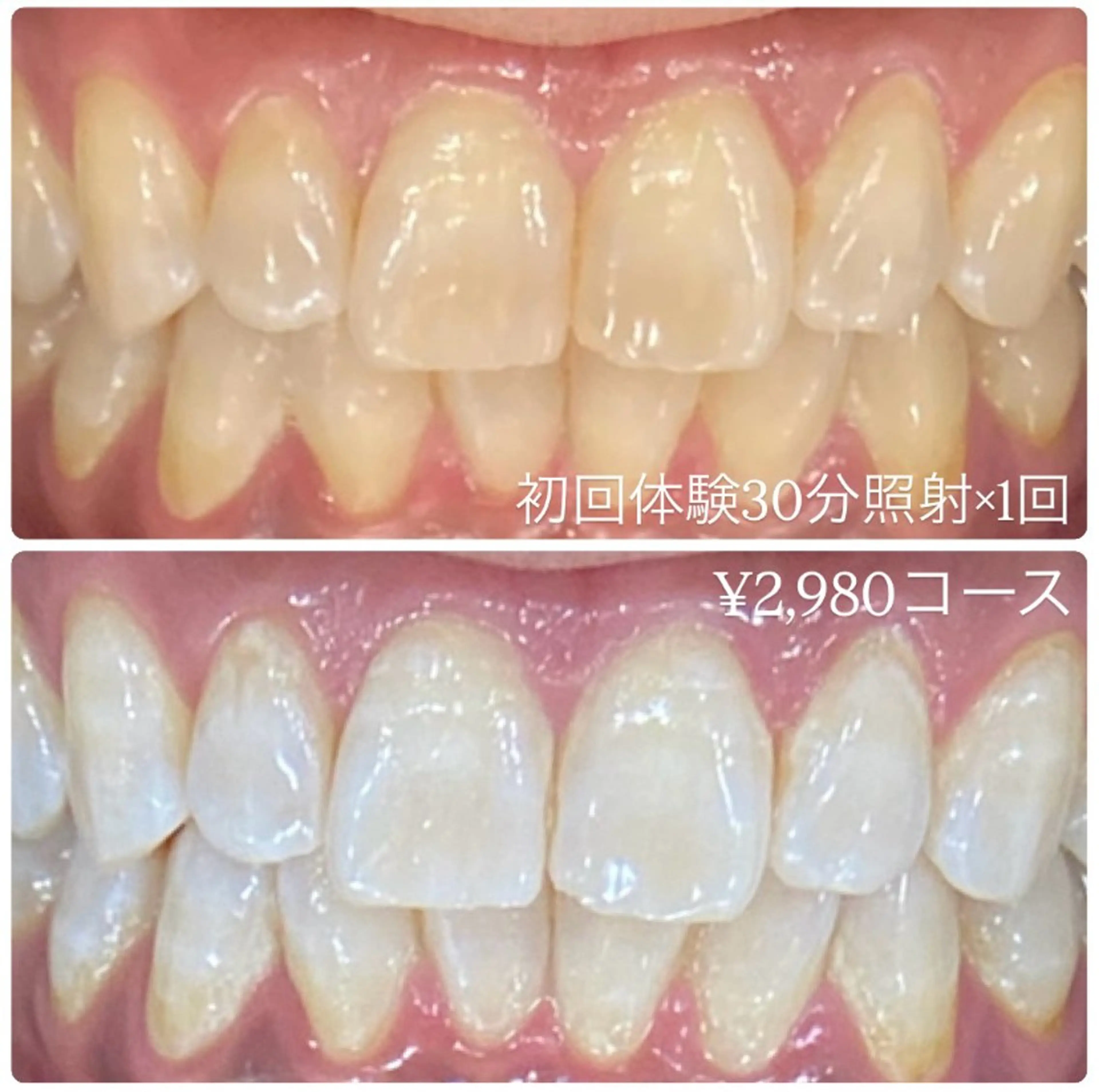 PLATINUM Beauty 横浜店所属・ホワイトニングルーム 横浜店のその他イメージ