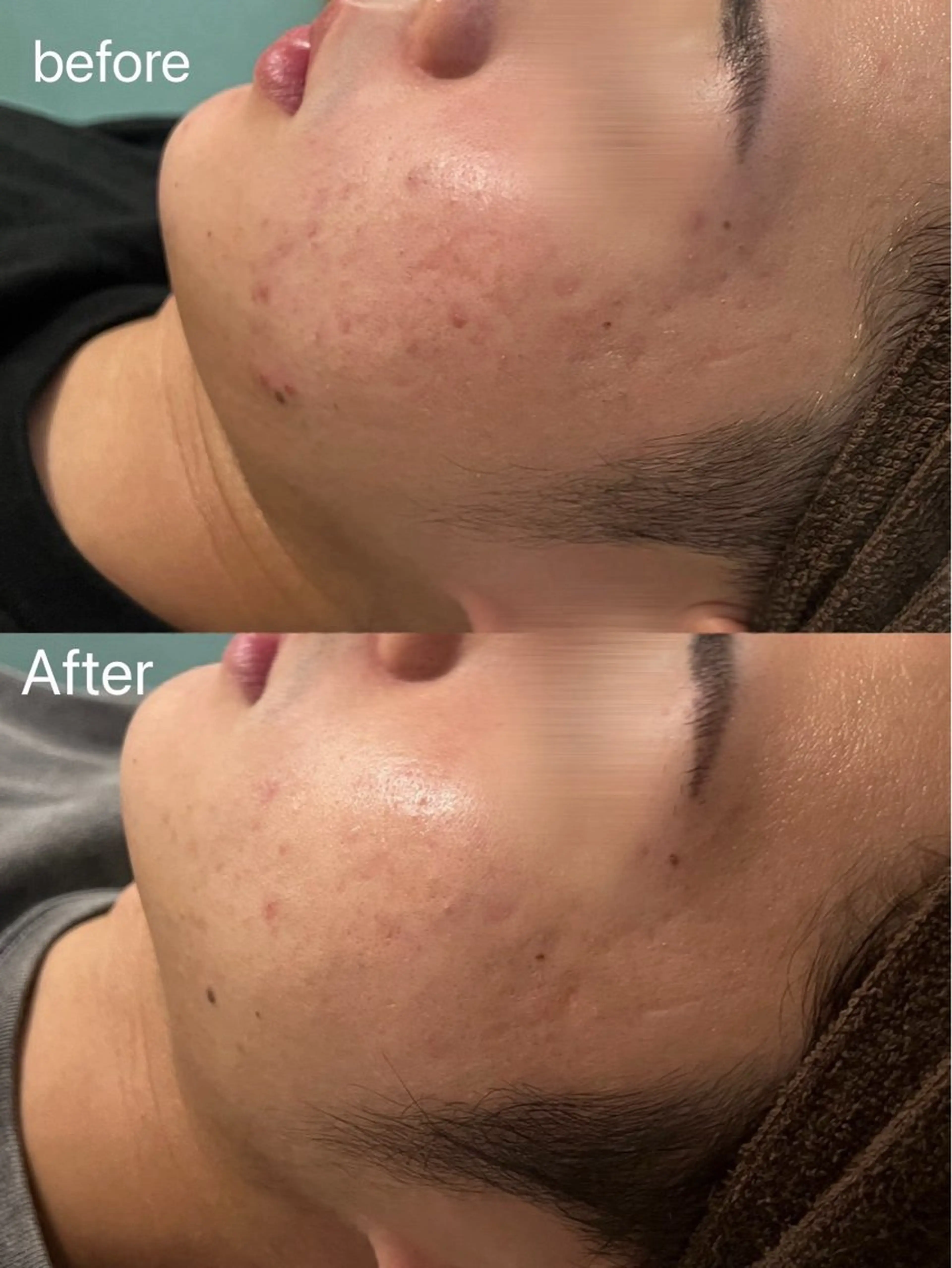 Belleつくば店所属・鈴木 華咲のエステ・リラクイメージ