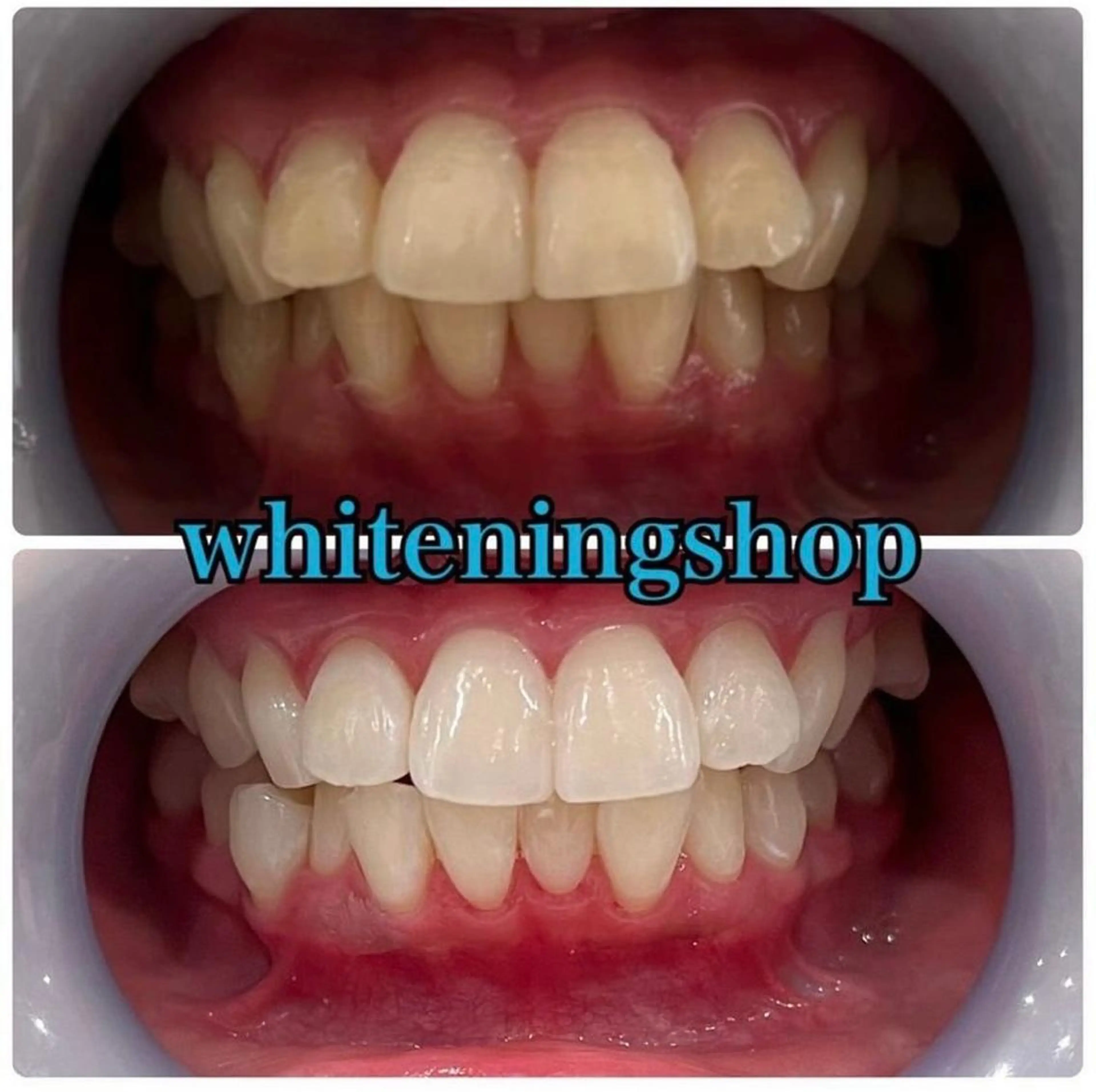 ホワイトニング ショップ吉祥寺店のエステ・リラクイメージ