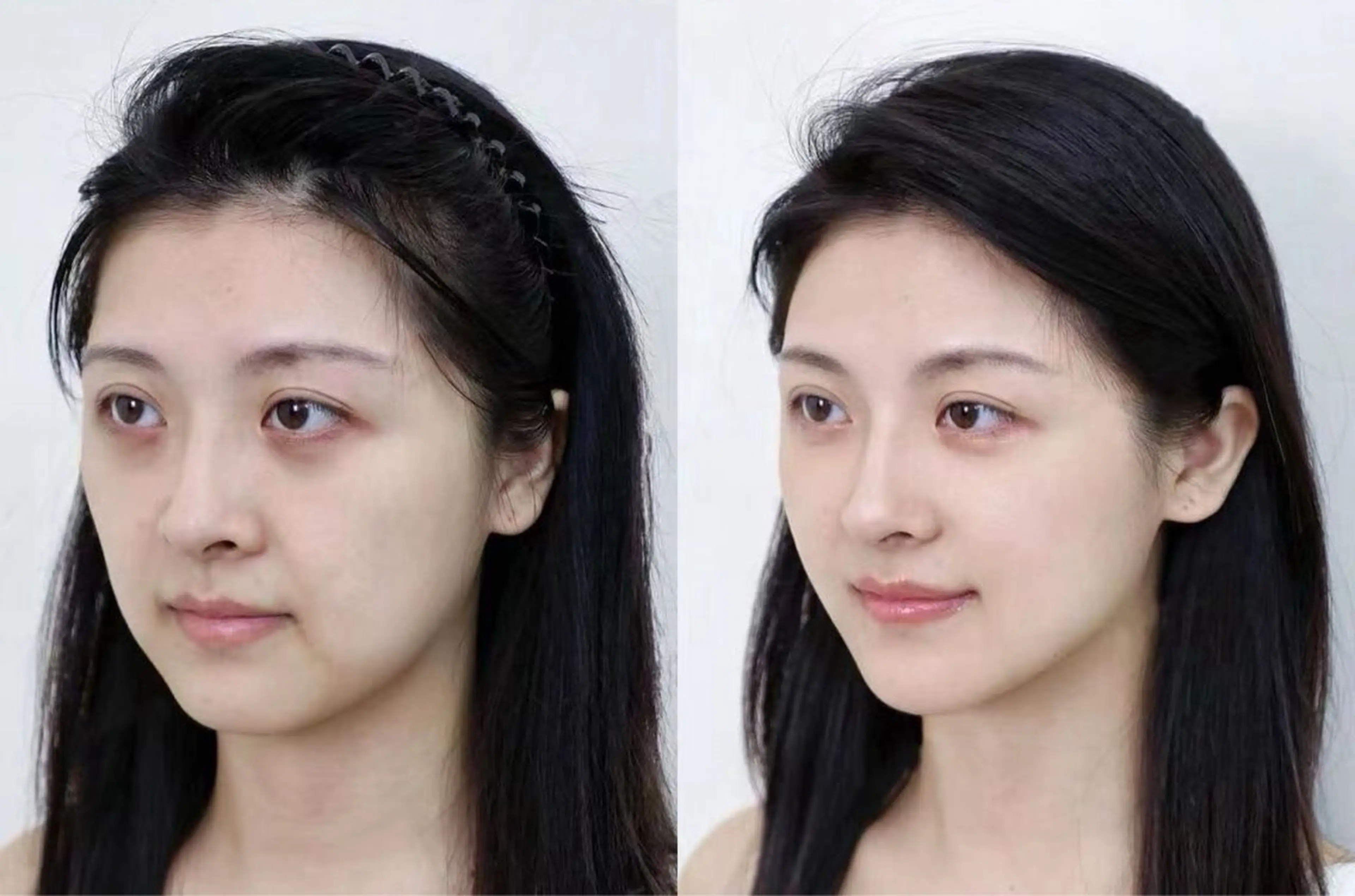 マツエク・マツパ エステ aliaハイフ&水光ジェットサロン所属・aliaハーブ水光店 エステティシャン募集のエステ・リラクイメージ