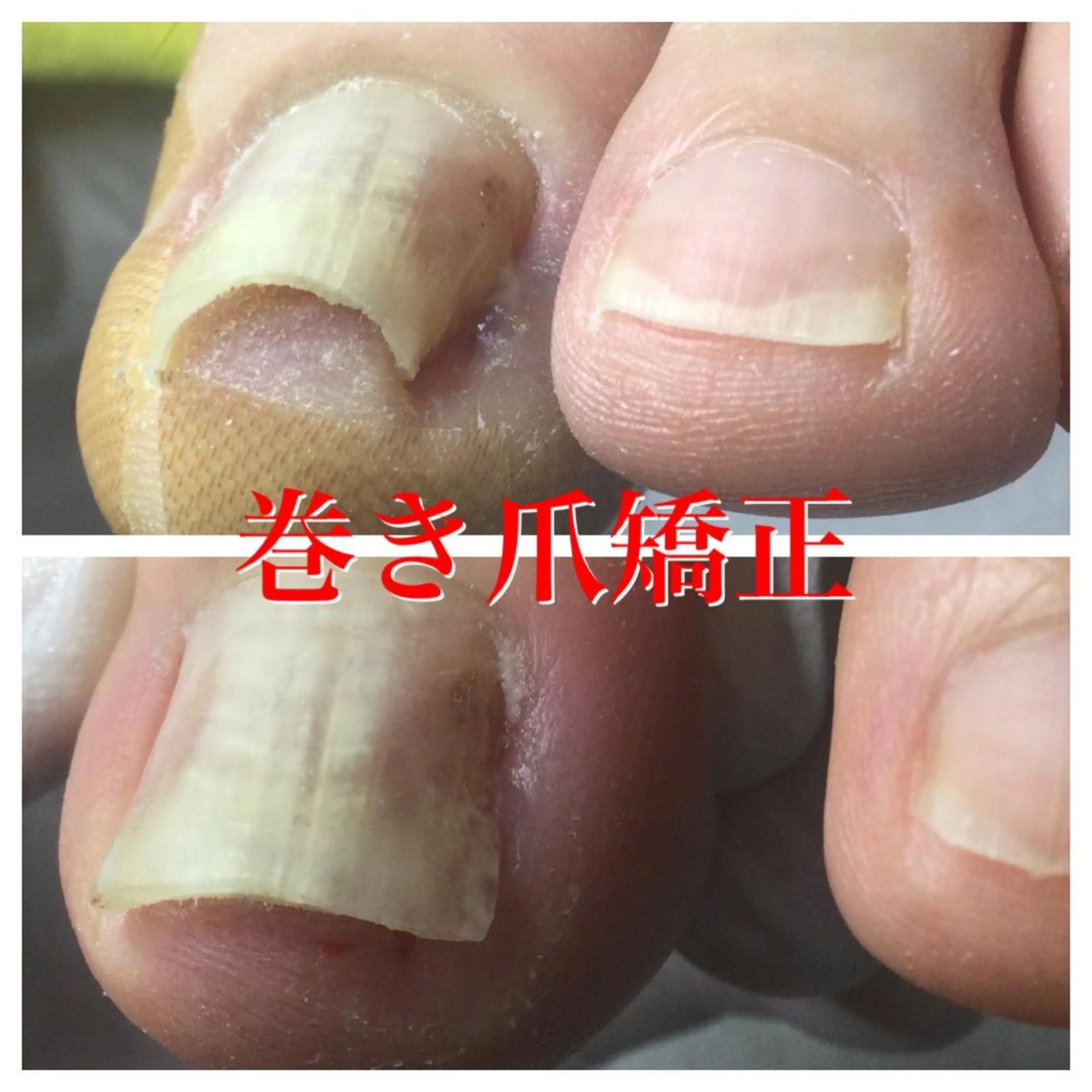 メンズ ネイル その他 ドクターネイル爪革命 takahashiのその他イメージ