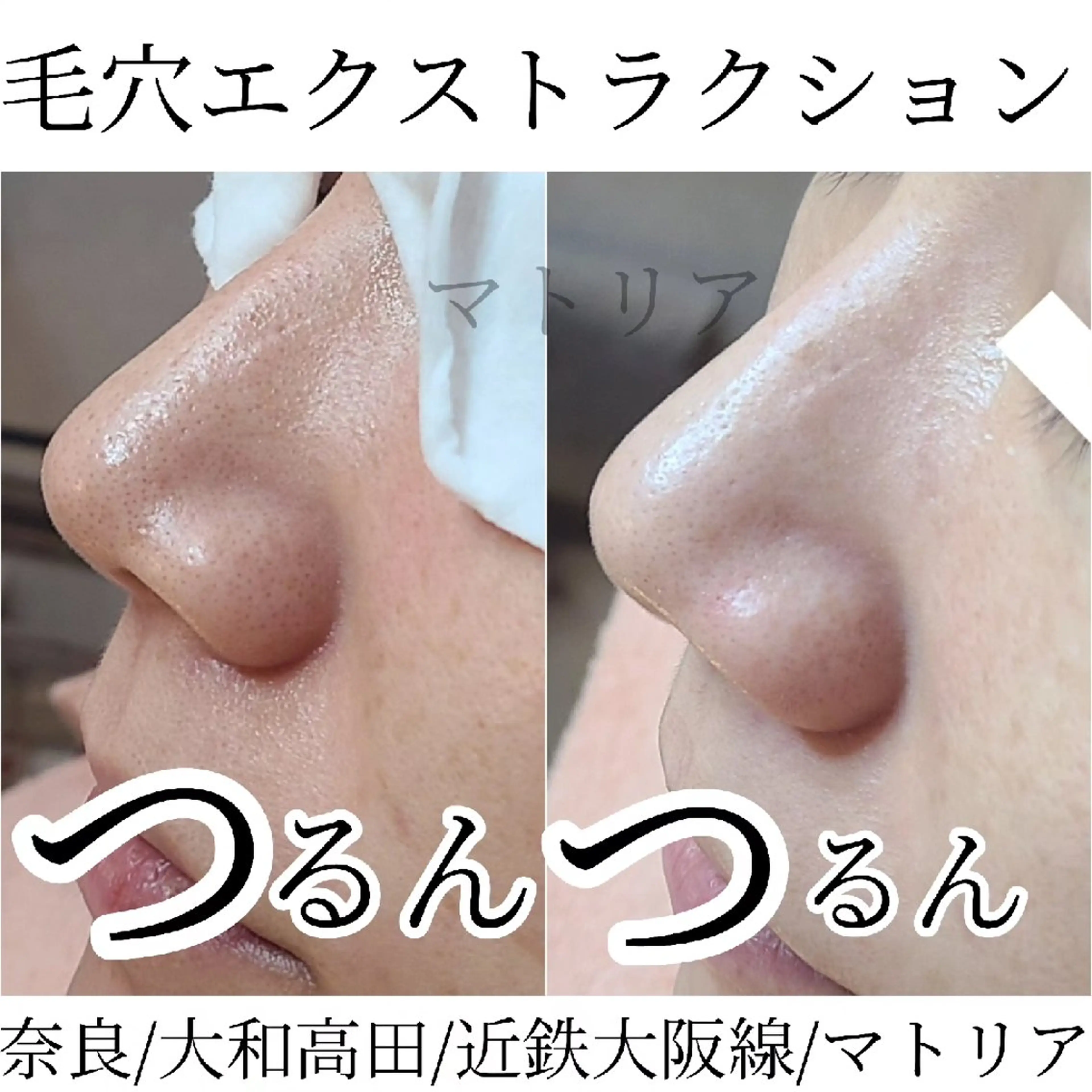 小顔と美肌 まごころエステMatoria所属・小顔 美肌専門 Matoriaのエステ・リラクイメージ