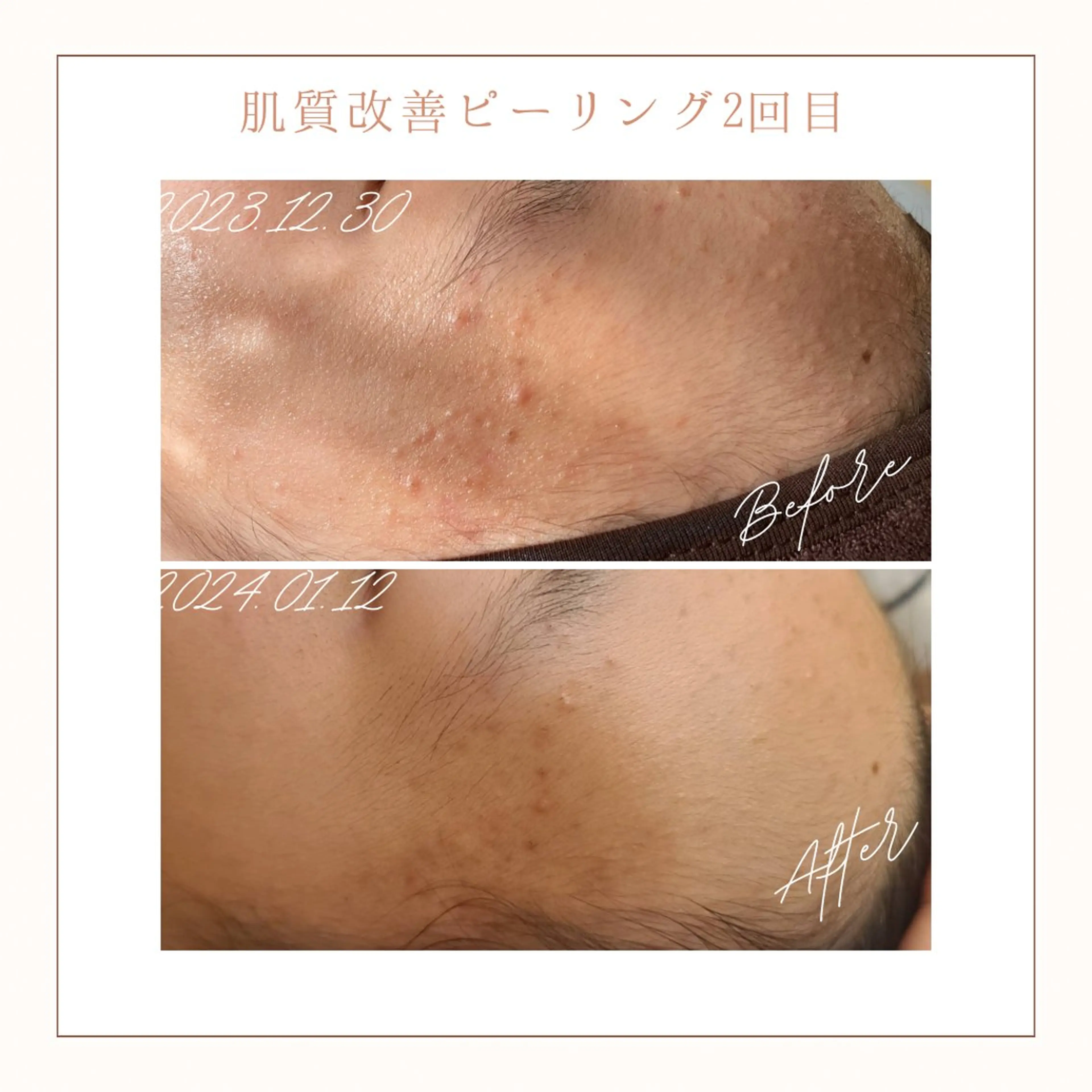 エステ リラク 小顔×肌質改善サロン soin〔ソワン〕のエステ・リラクイメージ