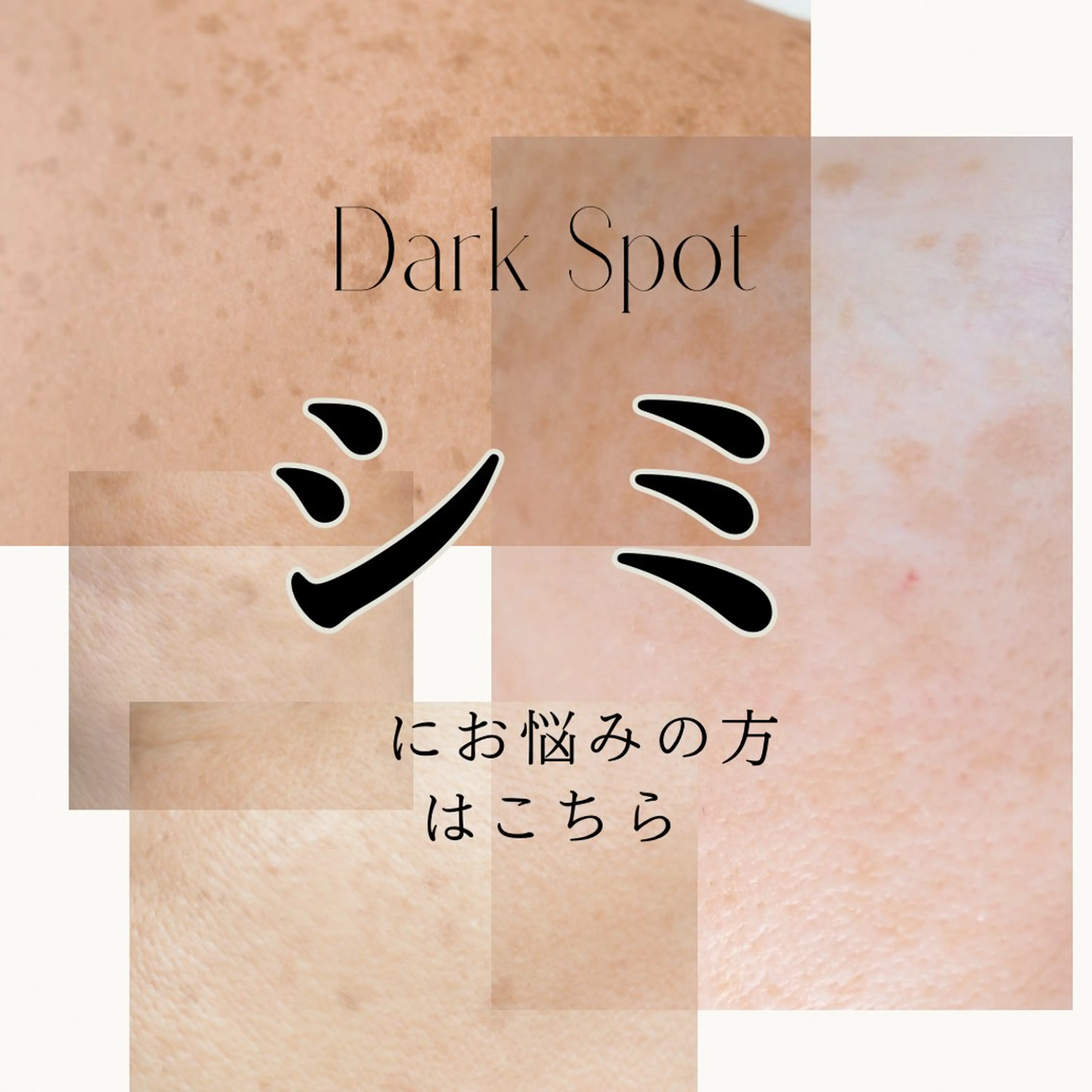 【個数無制限シミ改善コース】スポット＆シャワーで全てのシミにアプローチするオリジナル施術！の写真