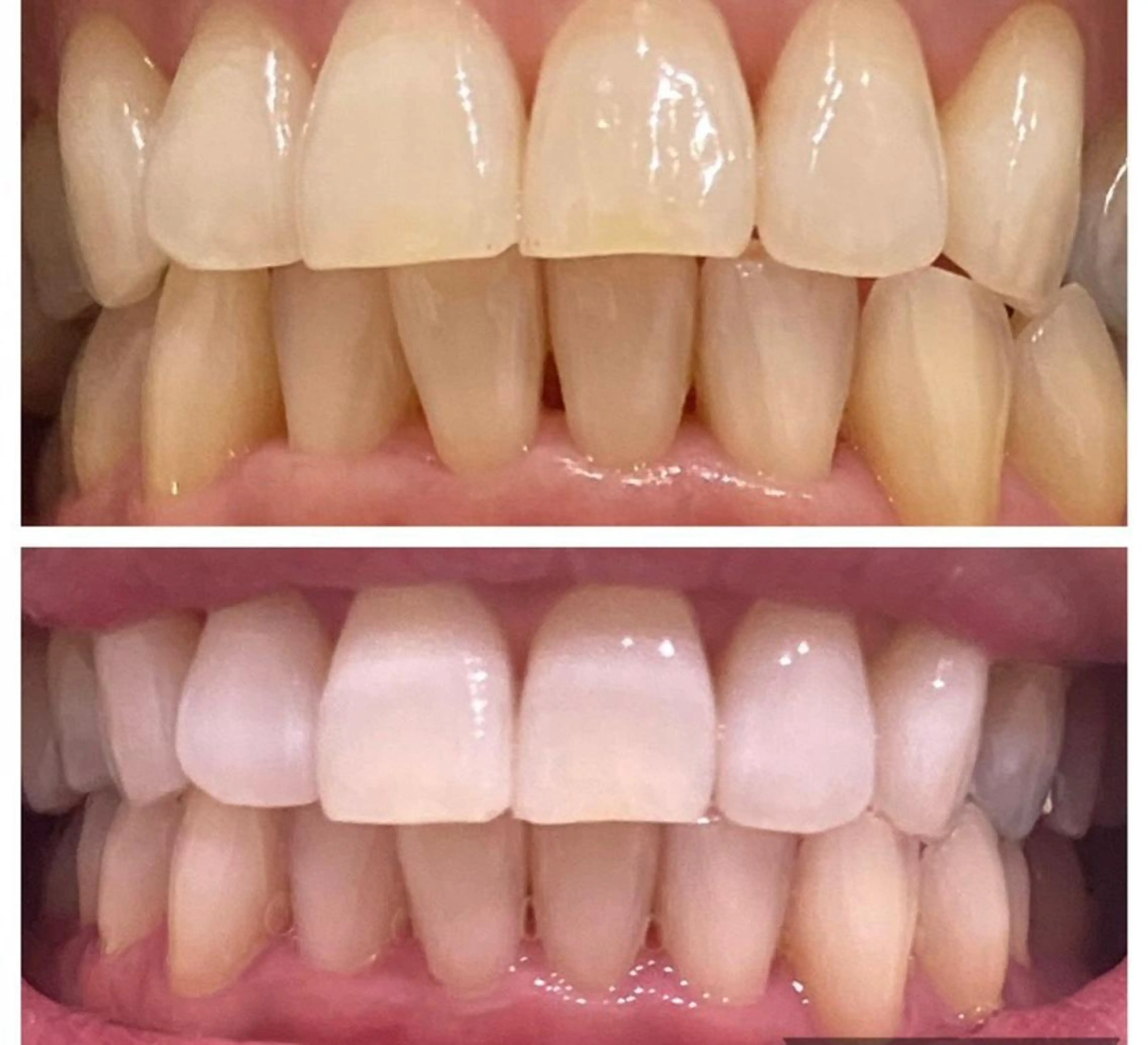 laluna saki...のその他イメージ