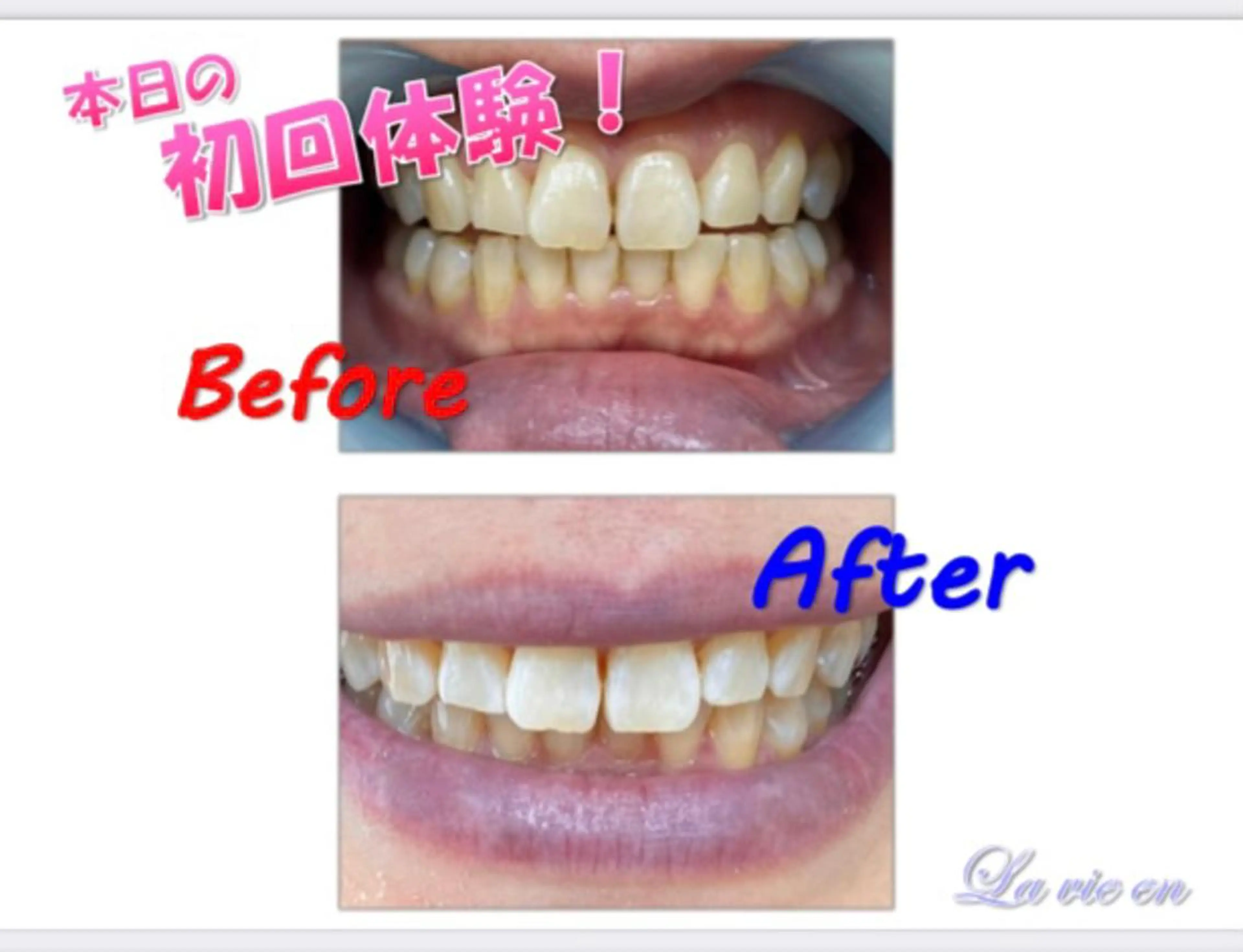 その他 セルフホワイトニングサロン　ラヴィアン所属・ホワイトニングサロン La vie enのその他イメージ