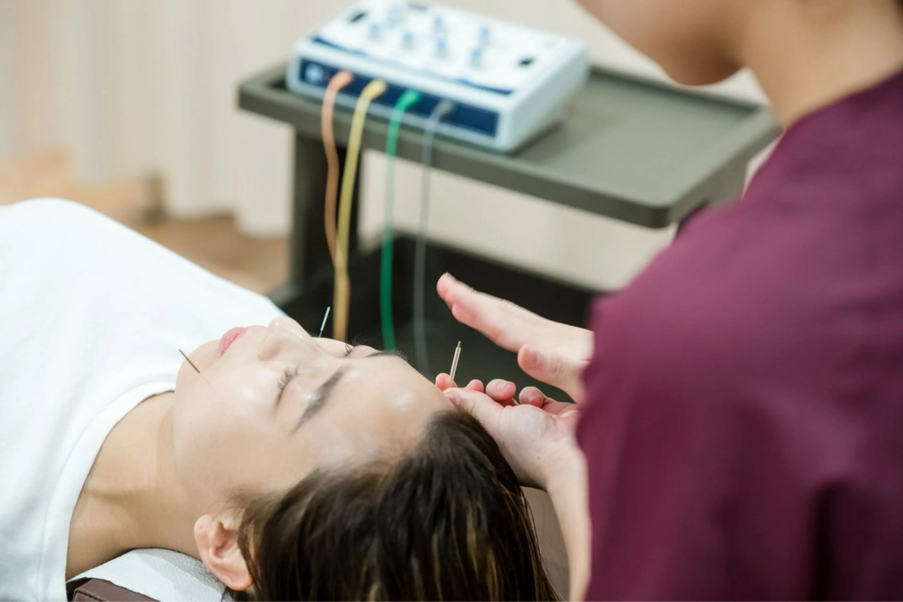 【噛み締め・食いしばり】に特化👊電気を流す美容鍼の写真