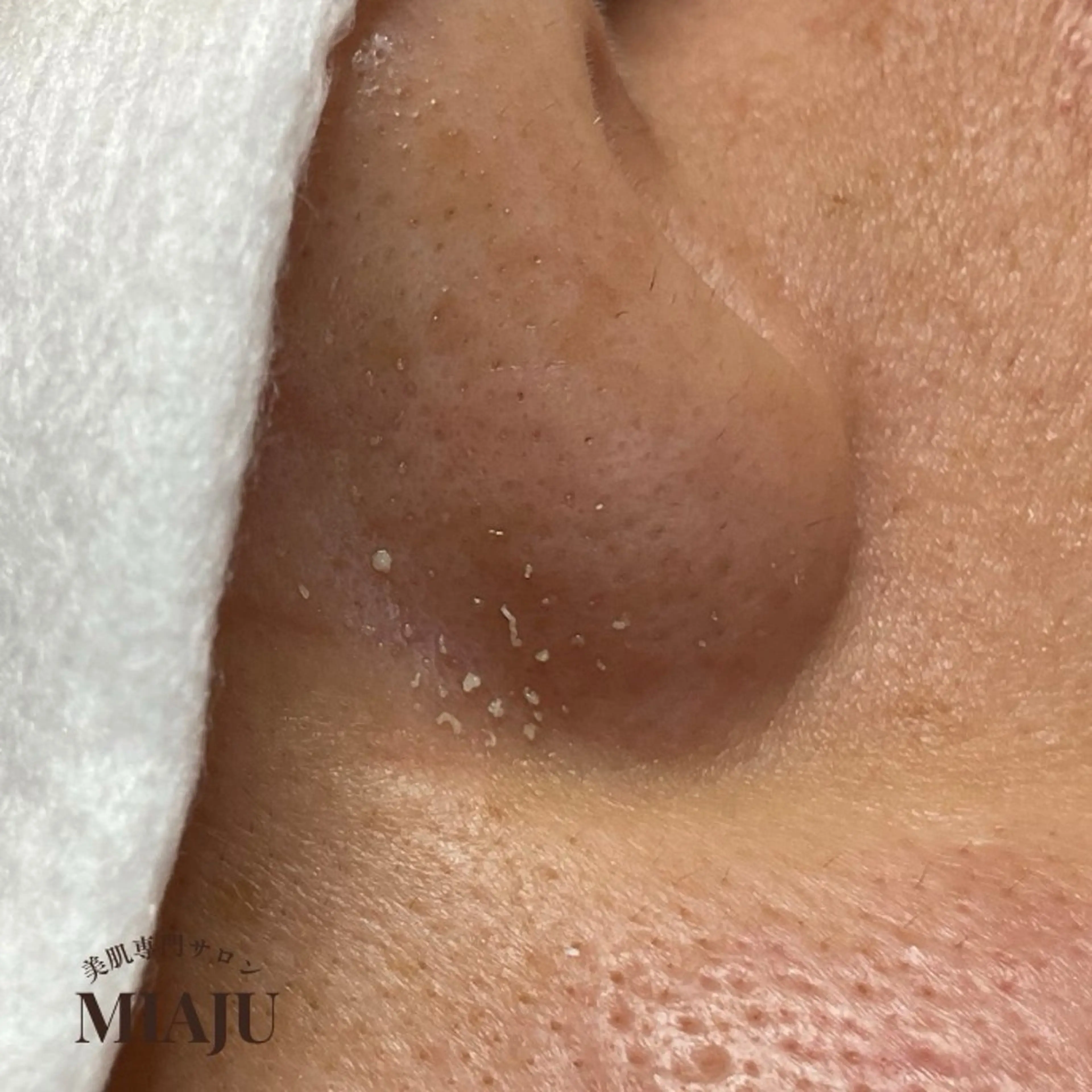 エステ 美肌専門サロン MIAJUのエステ・リラクイメージ