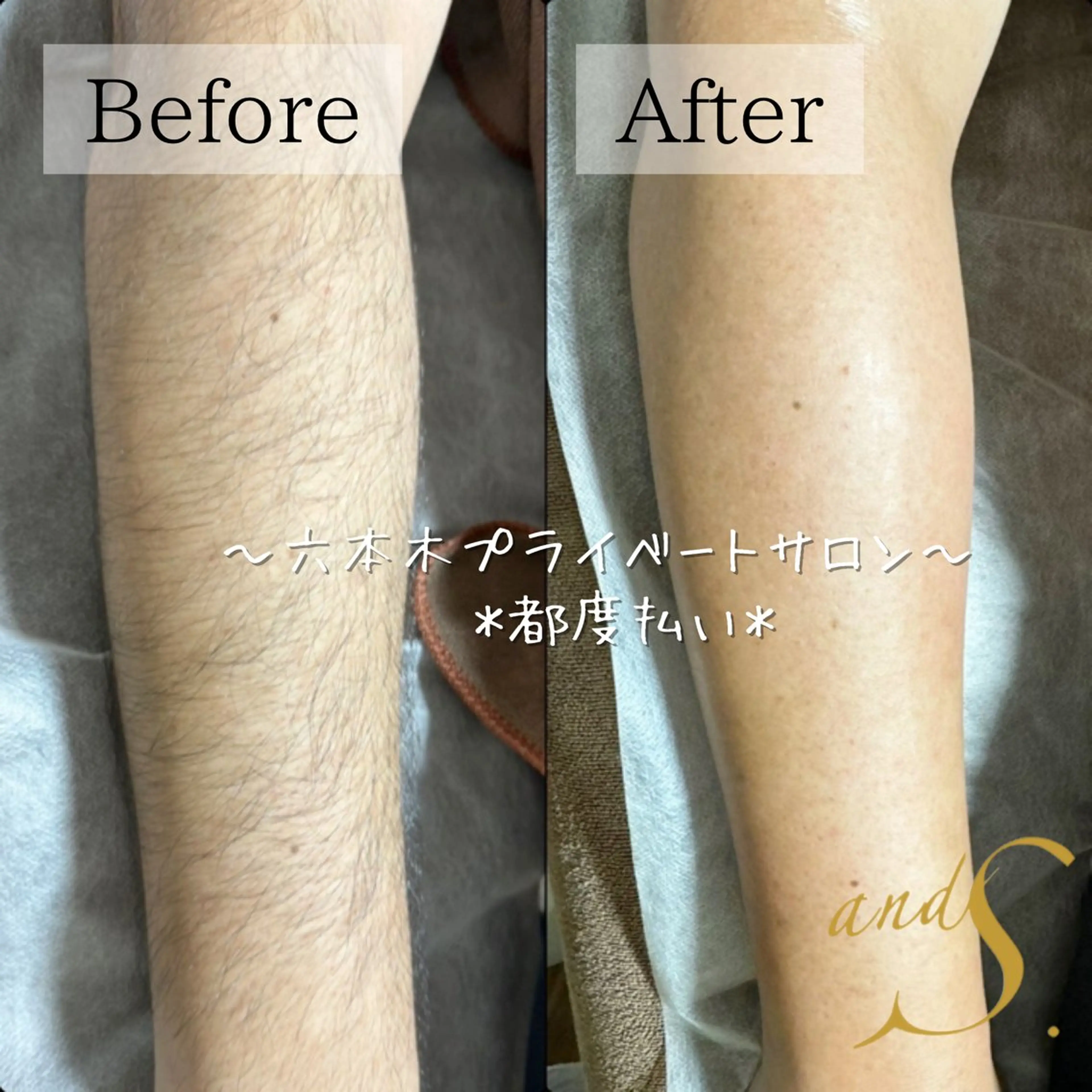 メンズ 脱毛 🌸🧡六本木 脱毛しずか🧡🫧の眉毛・アイブロウイメージ