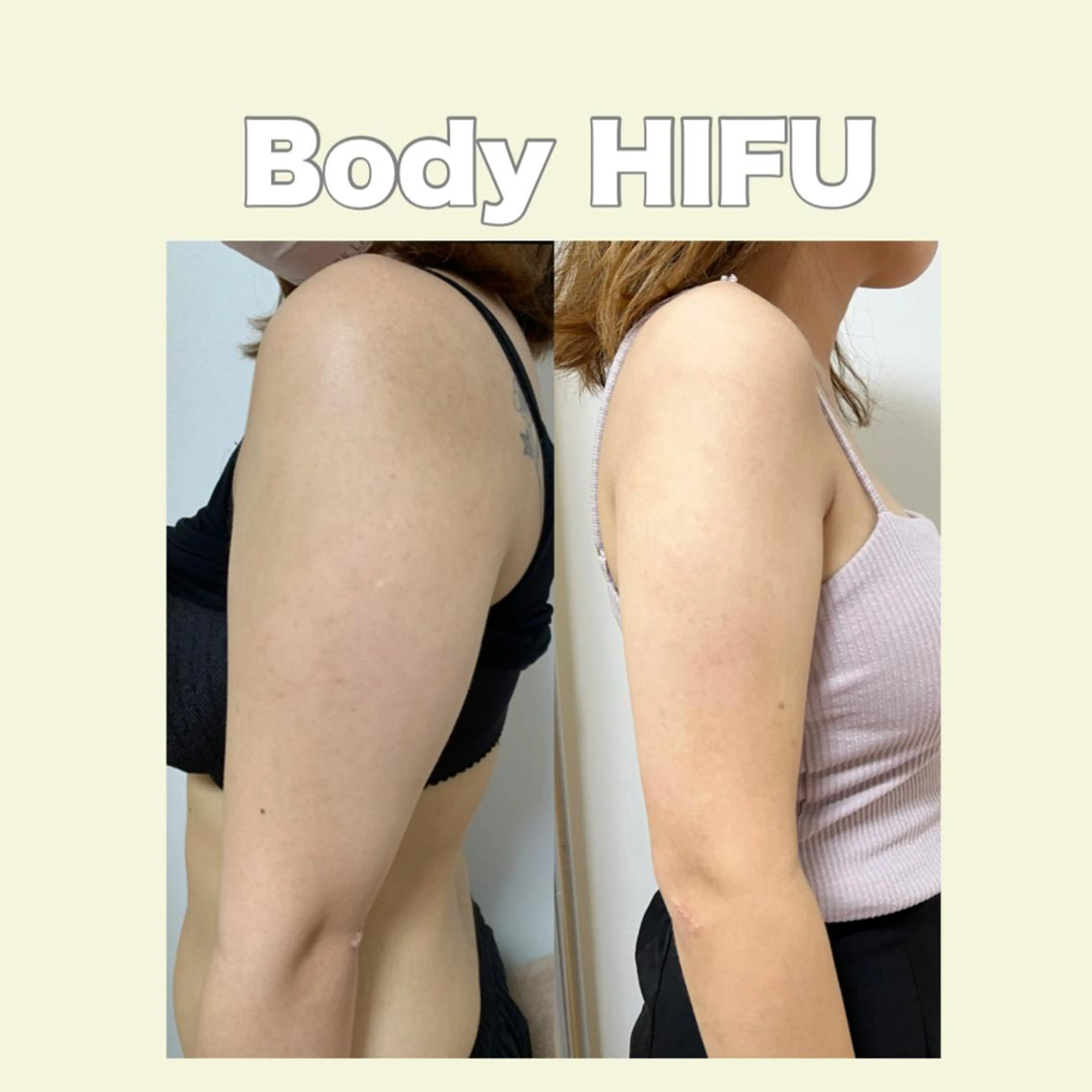 エステ 藤本 真心のネイルデザイン