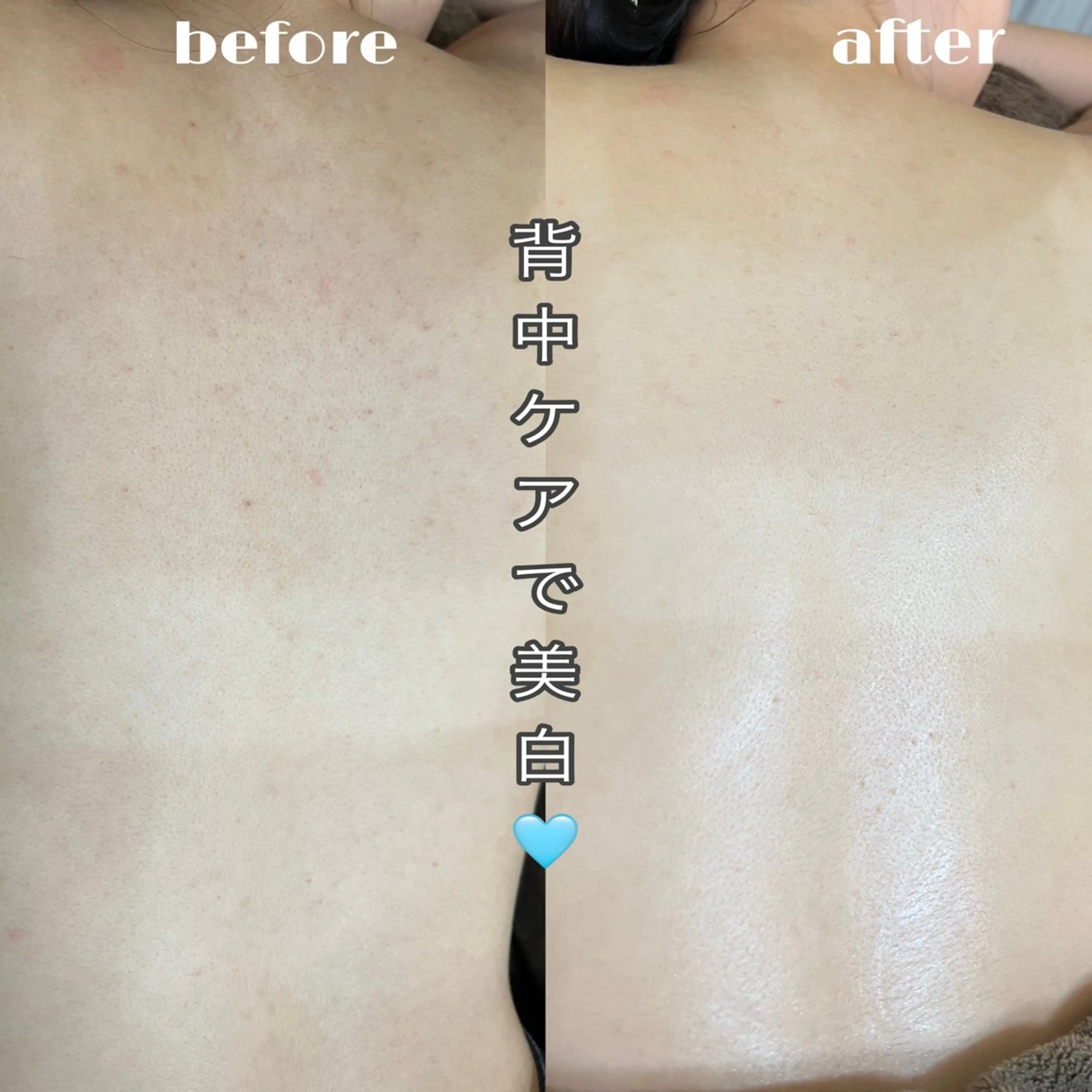 エステ Salon.Rire サロン リルのエステ・リラクイメージ