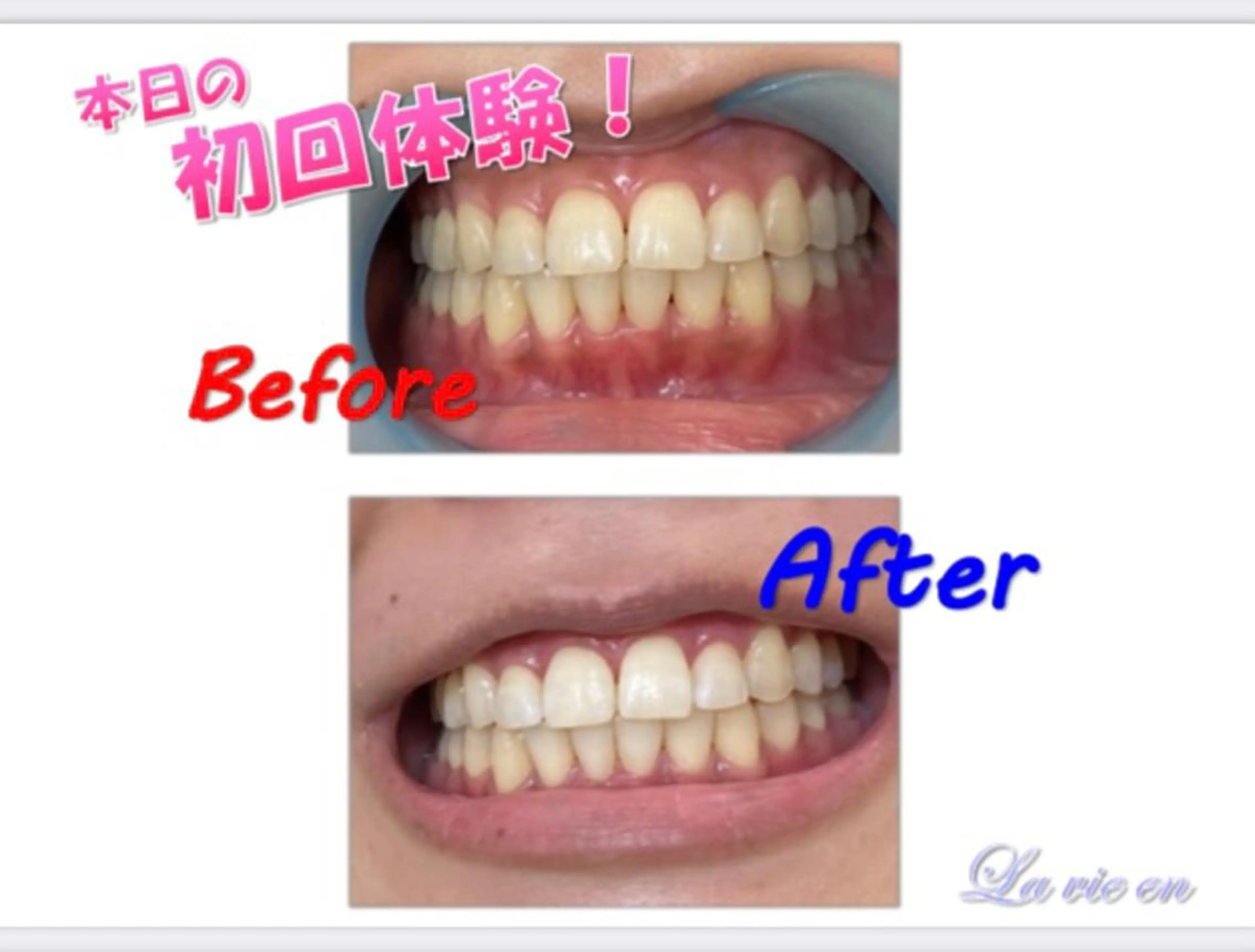 その他 セルフホワイトニングサロン　ラヴィアン所属・ホワイトニングサロン La vie enのその他イメージ