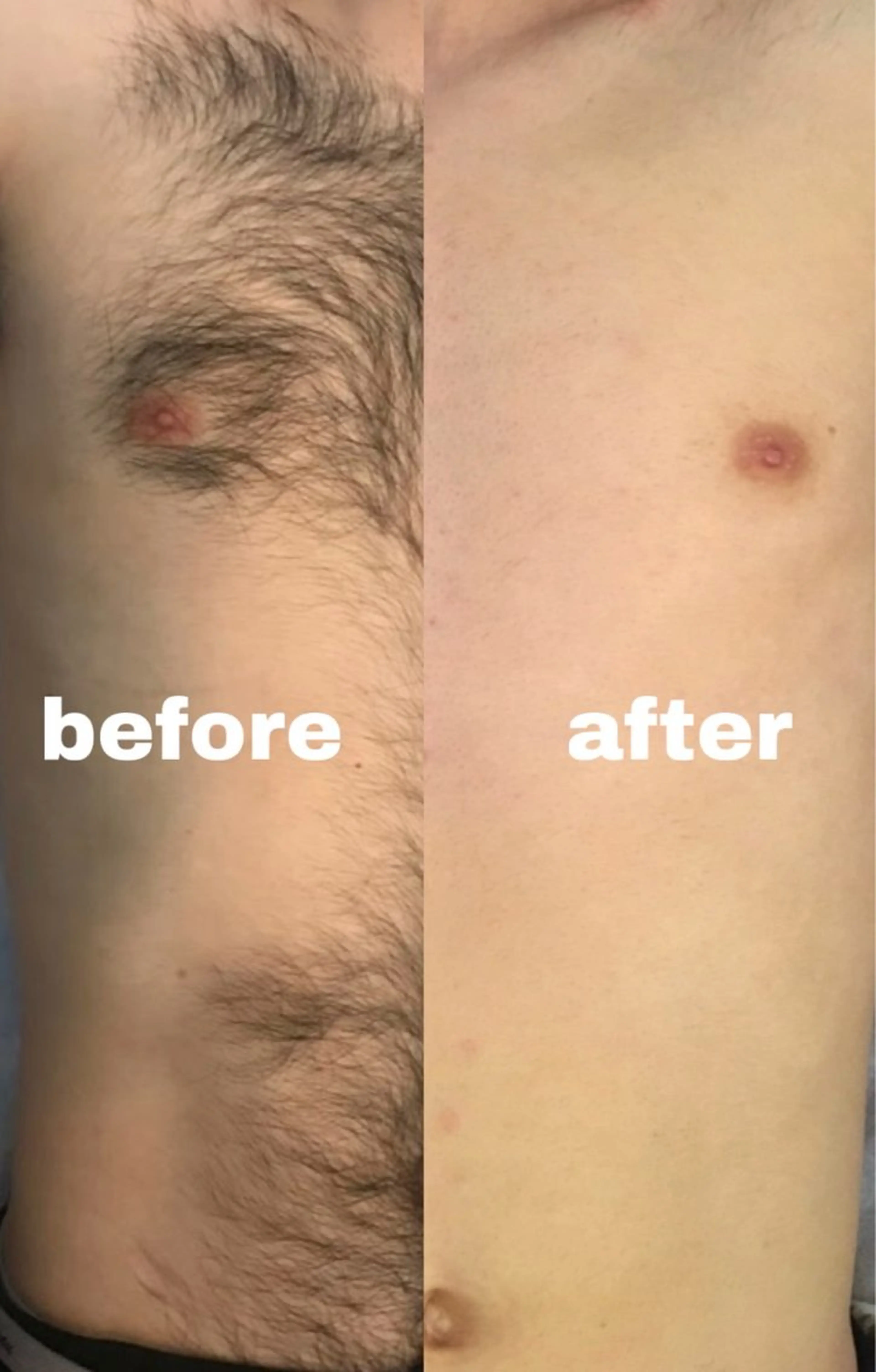 脱毛 YES脱毛サロン　大阪京橋店所属・メンズ脱毛サロン YESのエステ・リラクイメージ