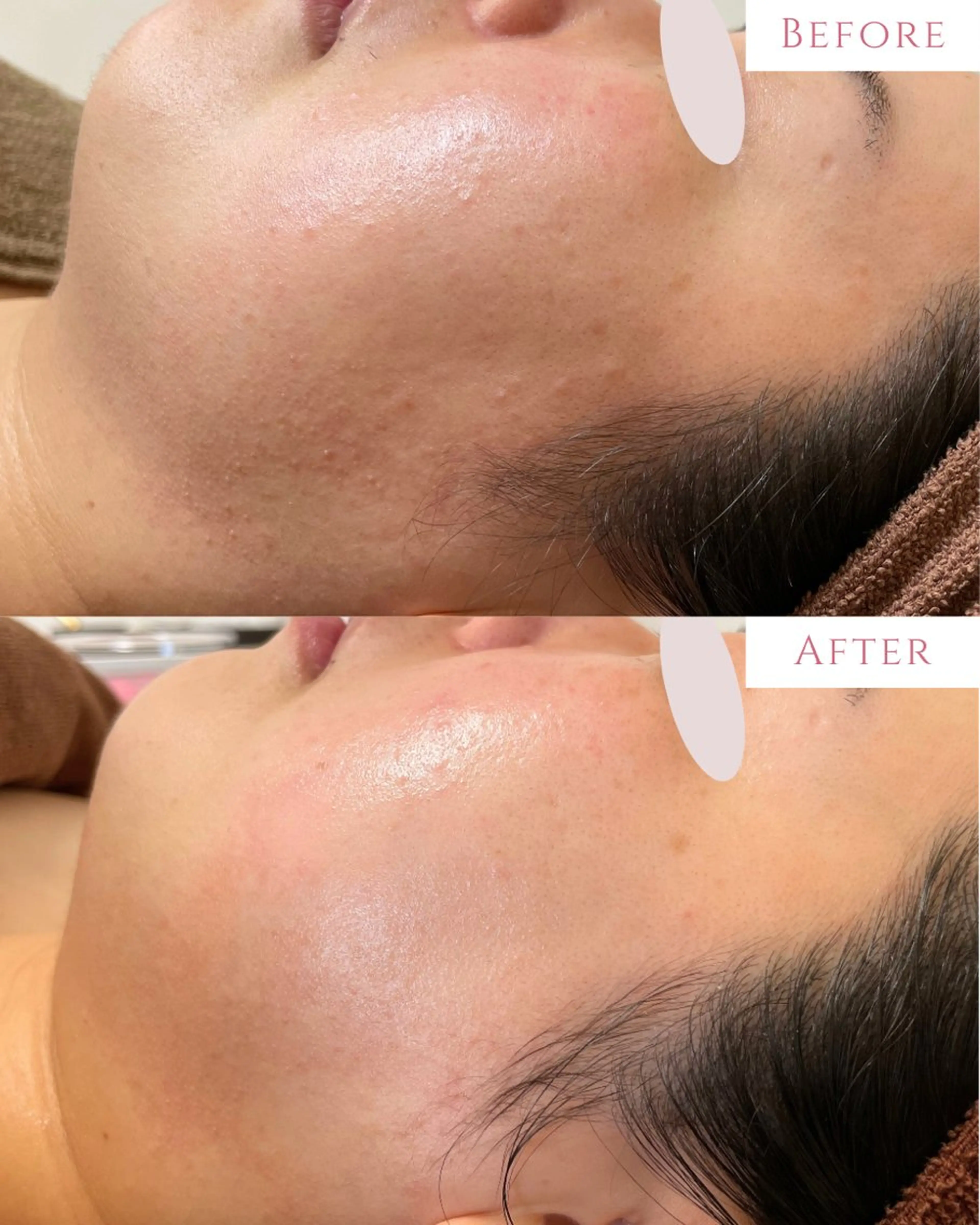 肌質改善サロン LesFleursのエステ・リラクイメージ