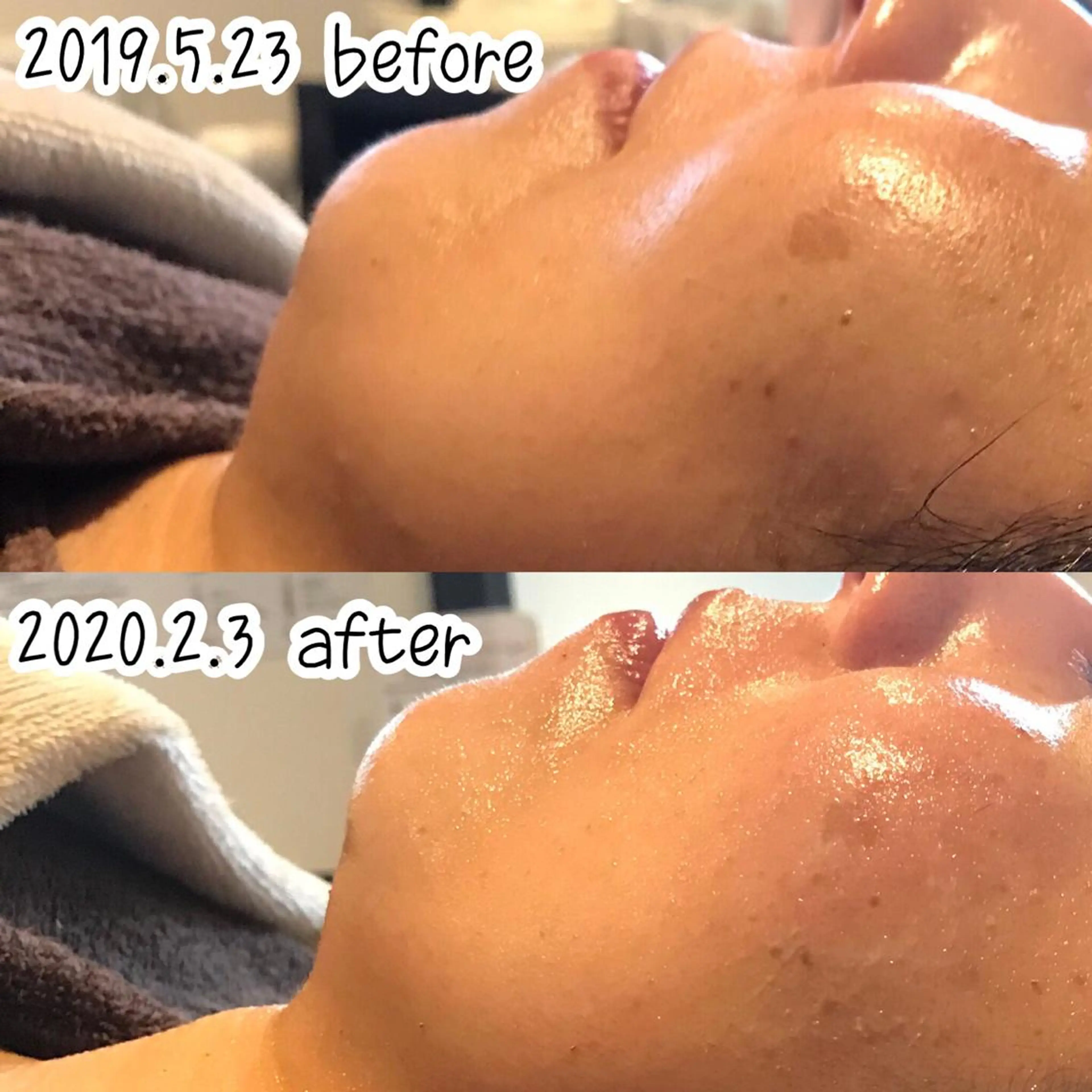 エステ 浜野 恵美のエステ・リラクイメージ