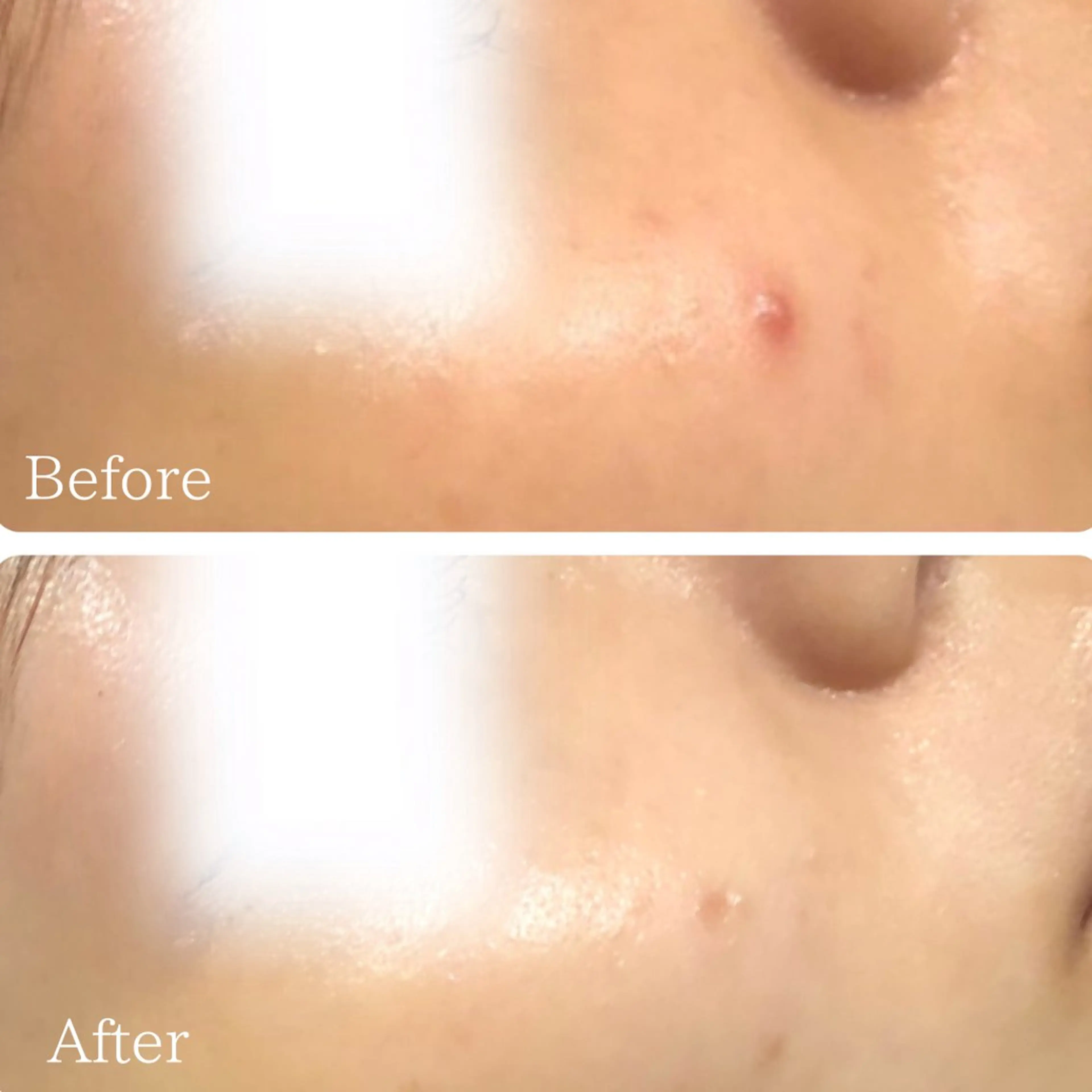 エステ 毛穴ニキビ専門 ビューティーグランツのエステ・リラクイメージ