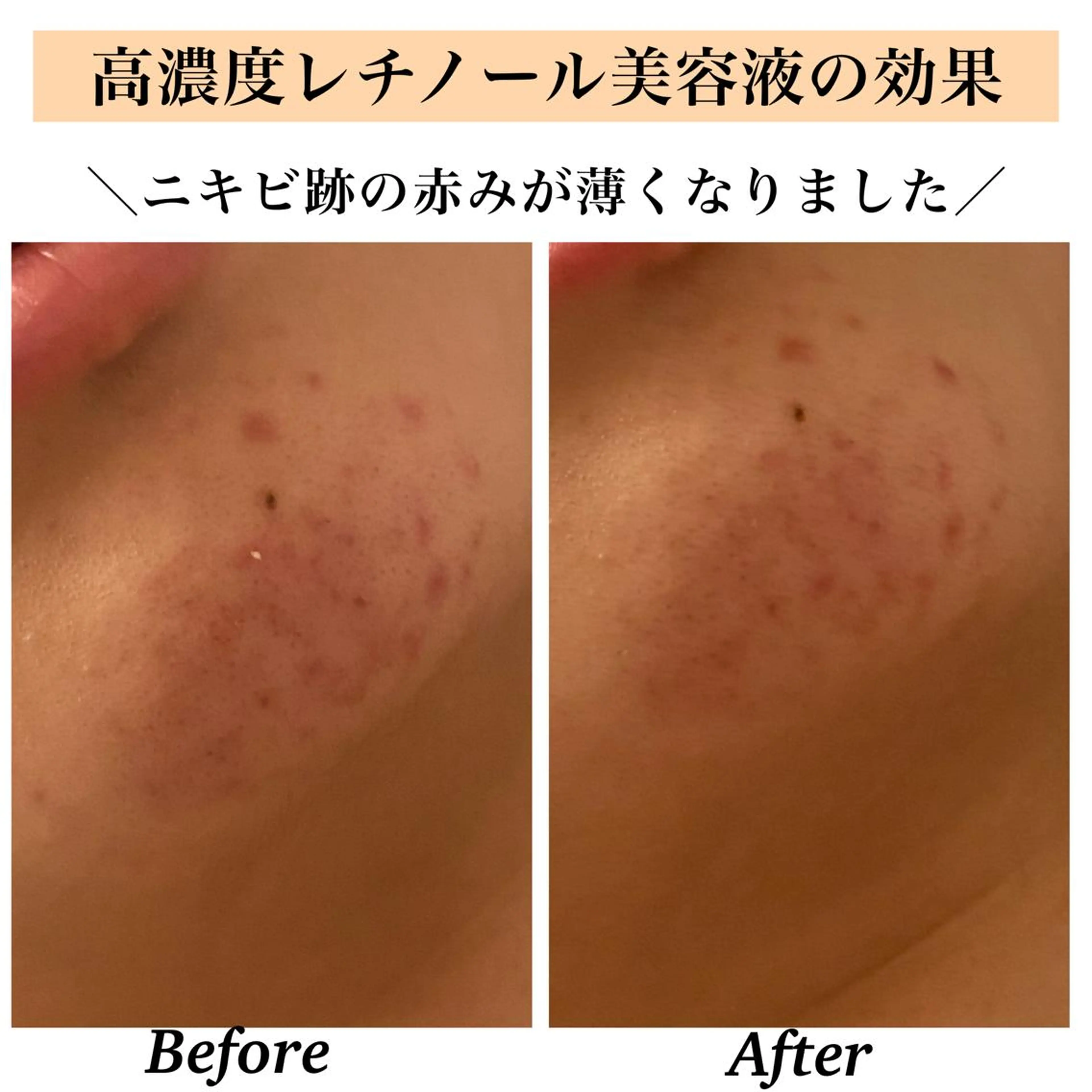 エステ リラク Bellesthe (ベルエステ)のエステ・リラクイメージ