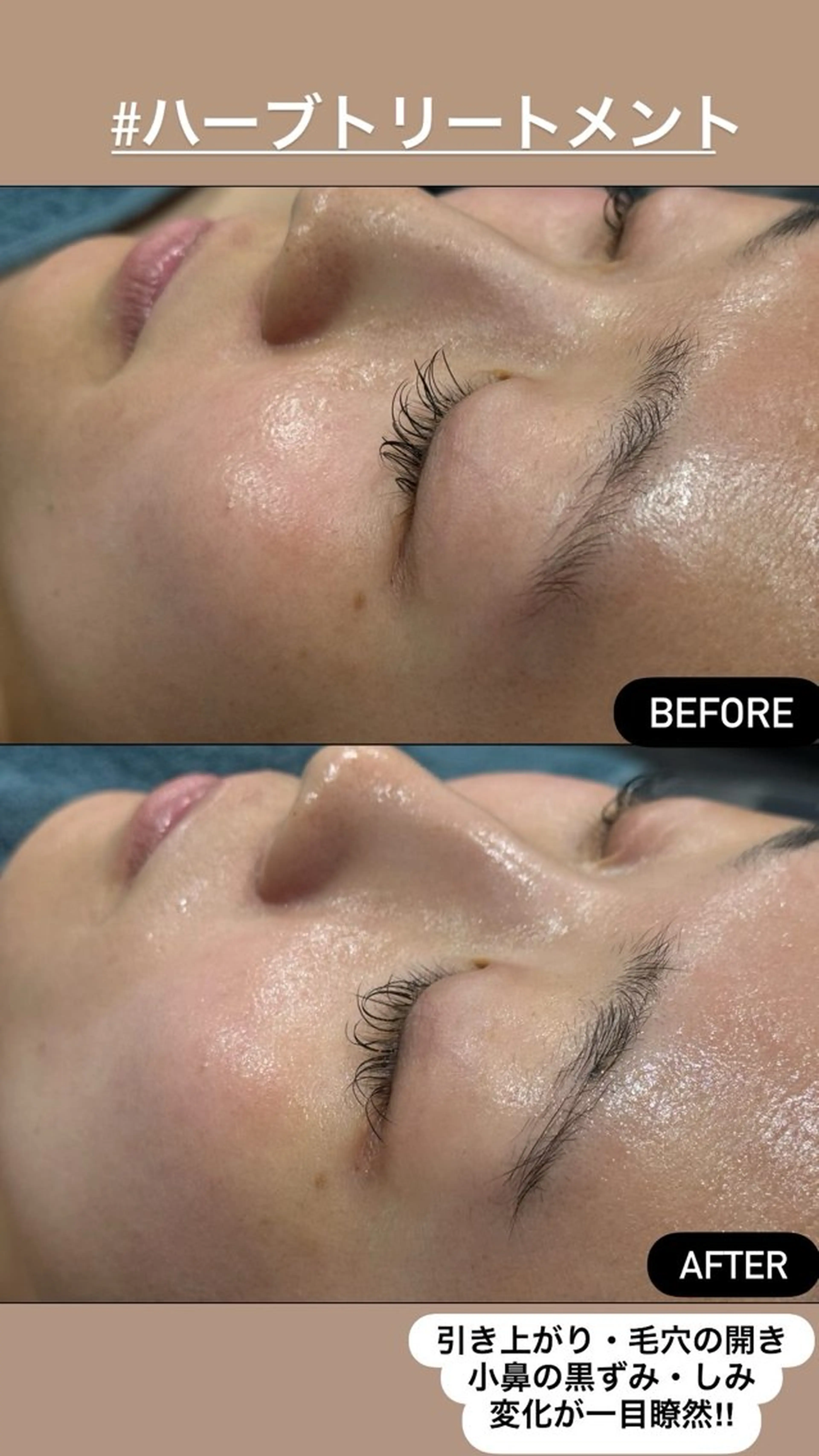 エステ LiZA エステティックサロンのエステ・リラクイメージ