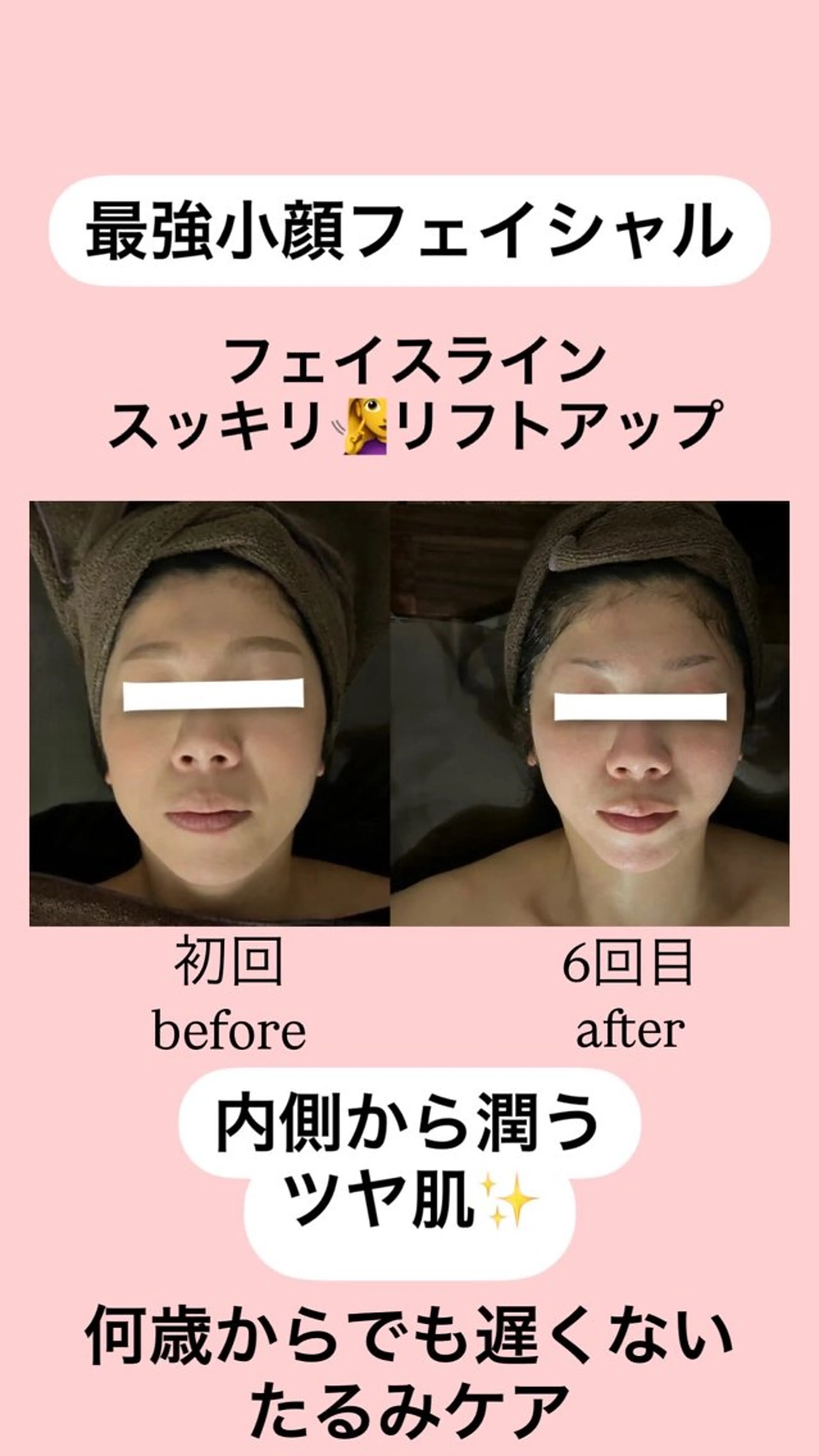 エステ リラク 美骨＆小顔矯正サロン　Clarte所属・骨から若返る美骨＆ 小顔サロンクラルテのエステ・リラクイメージ