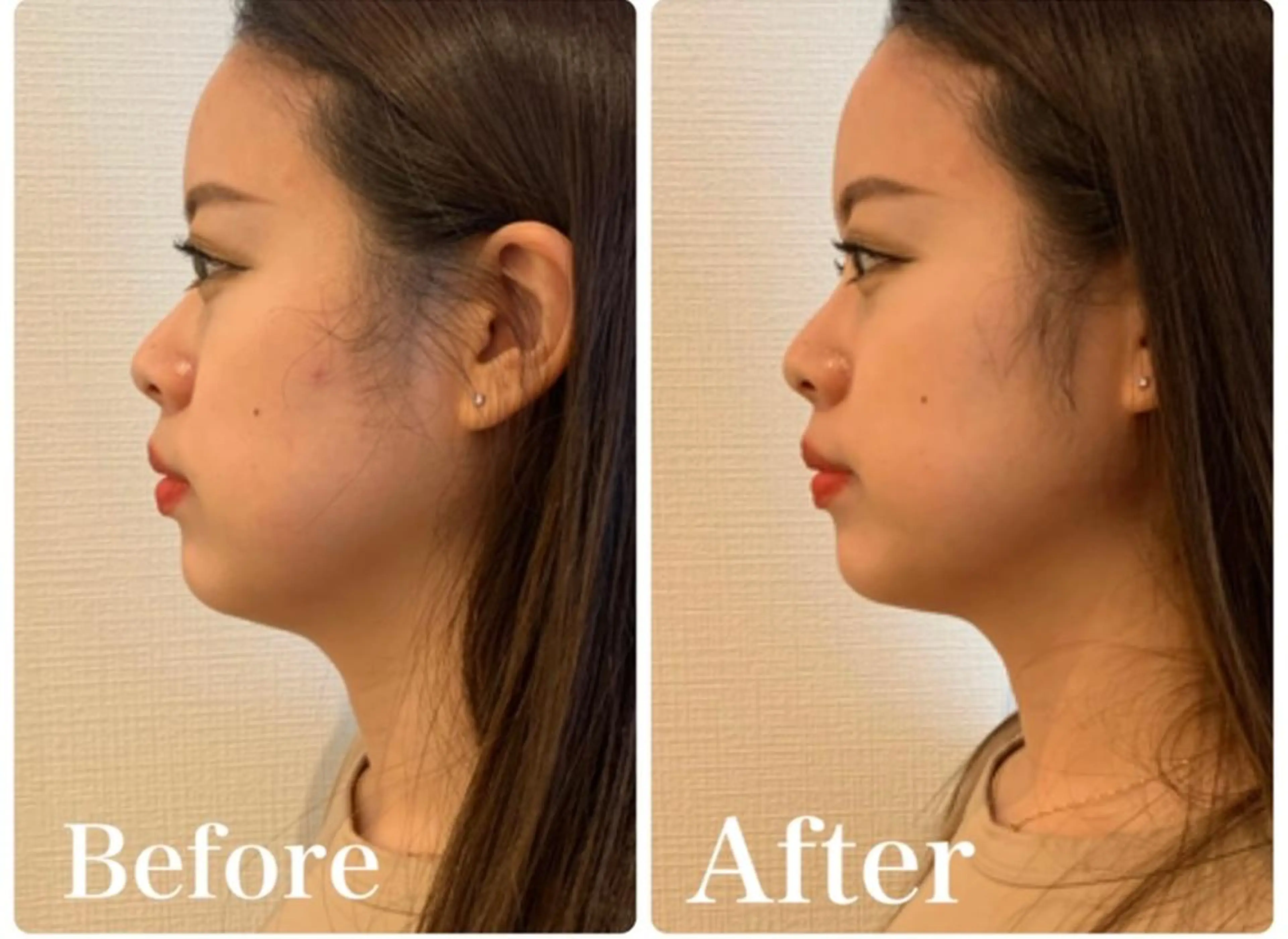 エステ リラク ベレディオ Miuraのエステ・リラクイメージ