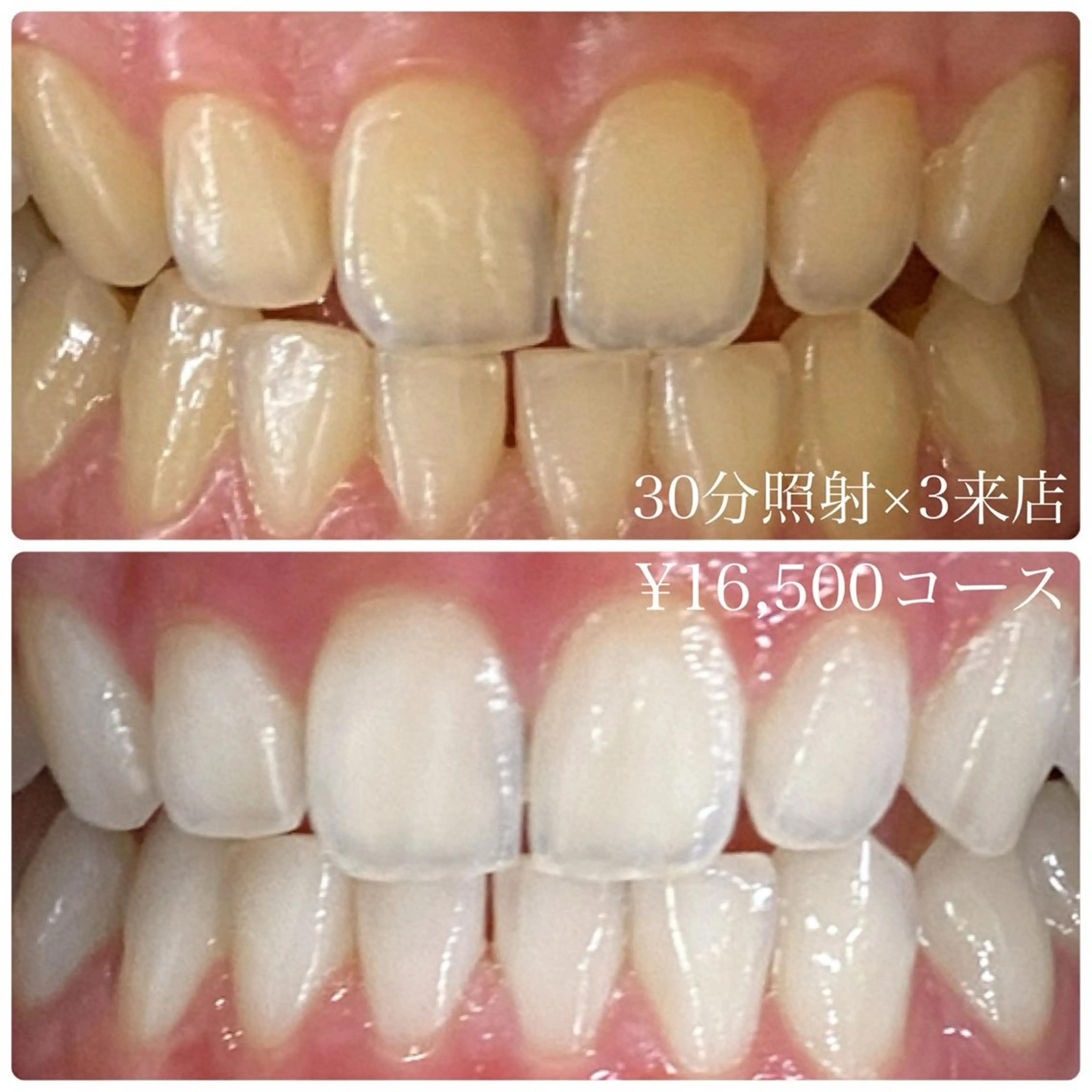 PLATINUM Beauty 横浜店所属・ホワイトニングルーム 横浜店のその他イメージ