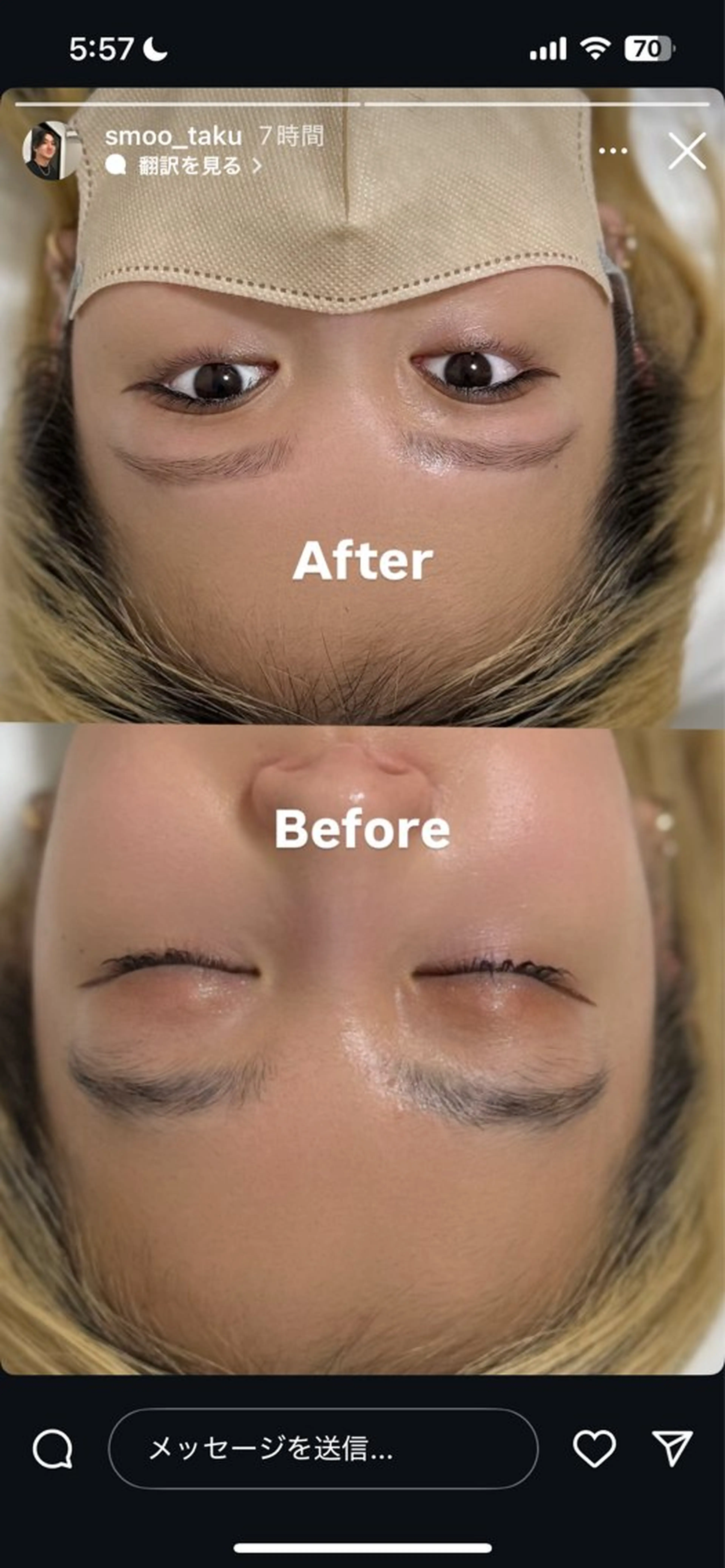 ワックス脱毛 眉カット その他(アイブロウ) Smoo アユミの眉毛・アイブロウイメージ