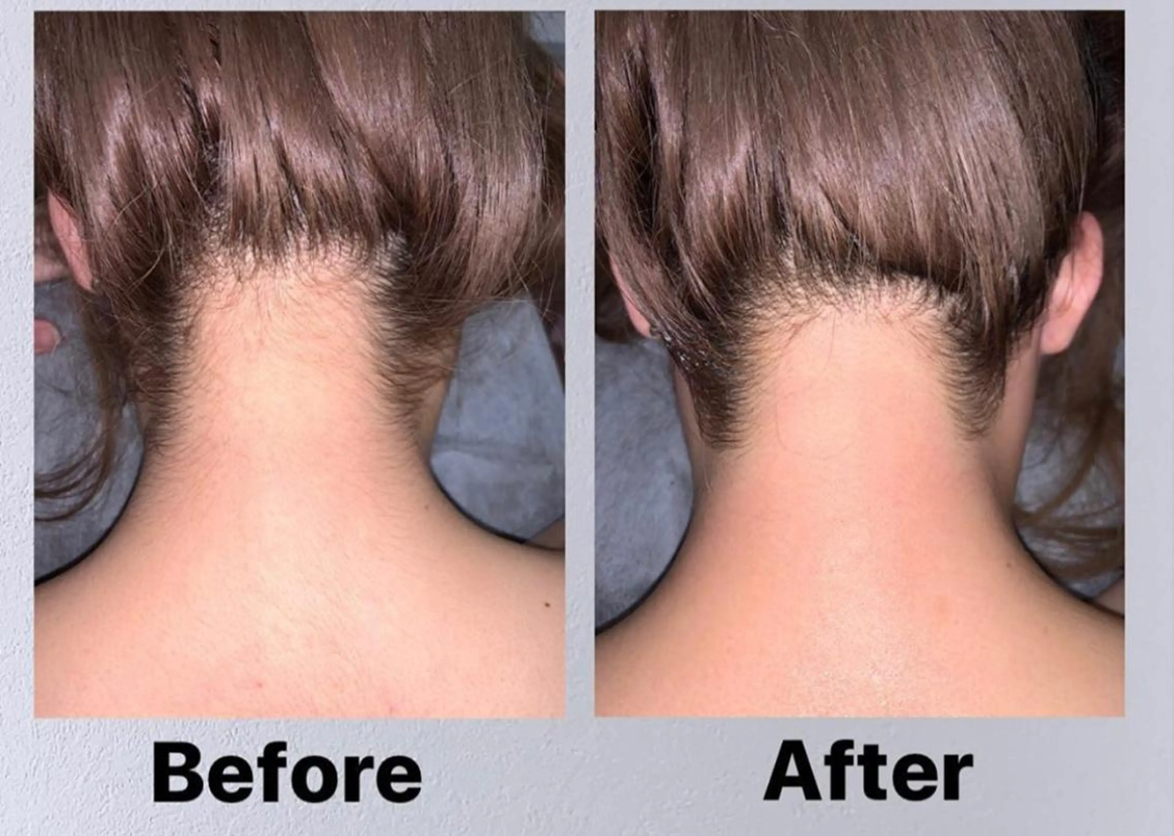 脱毛 QANAEL所属・QANAEL 小山のエステ・リラクイメージ