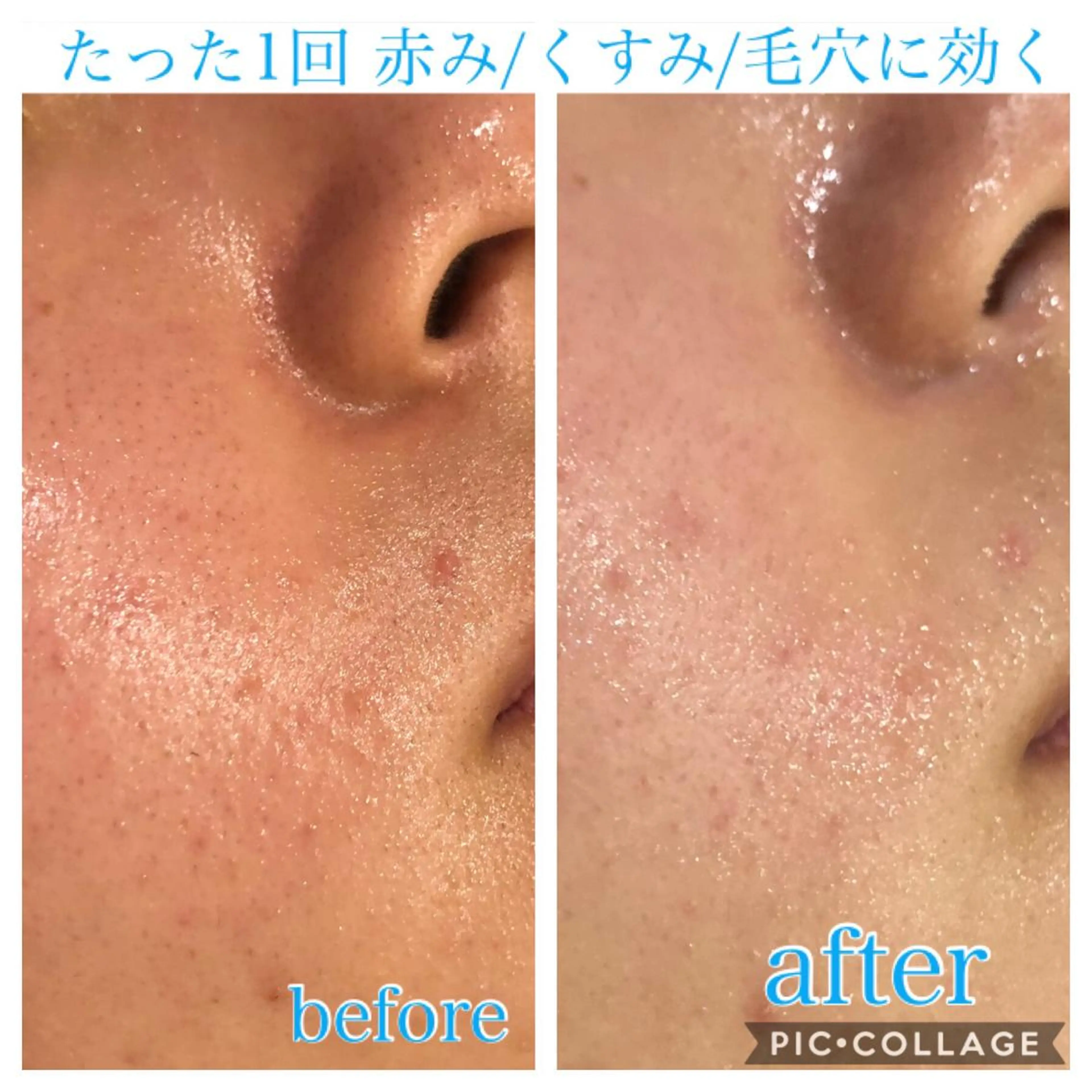 ショート カラー パーマ ヘアアレンジ メンズ キッズ ネイル マツエク・マツパ エステ リラク Ensor Clair所属・EnsorClair 代表　野口真央のエステ・リラクイメージ