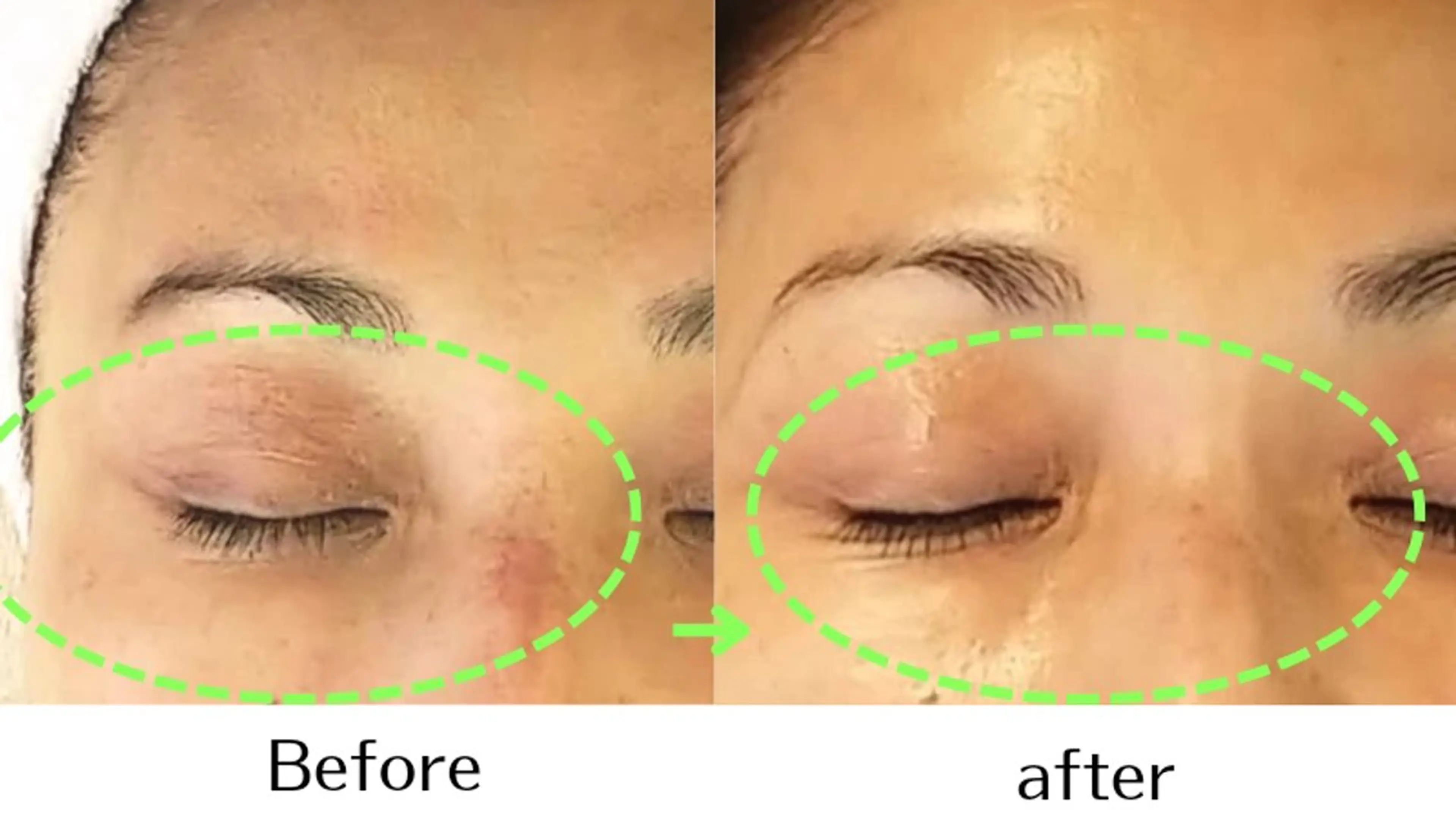 自然派フェイシャル やながわのエステ・リラクイメージ