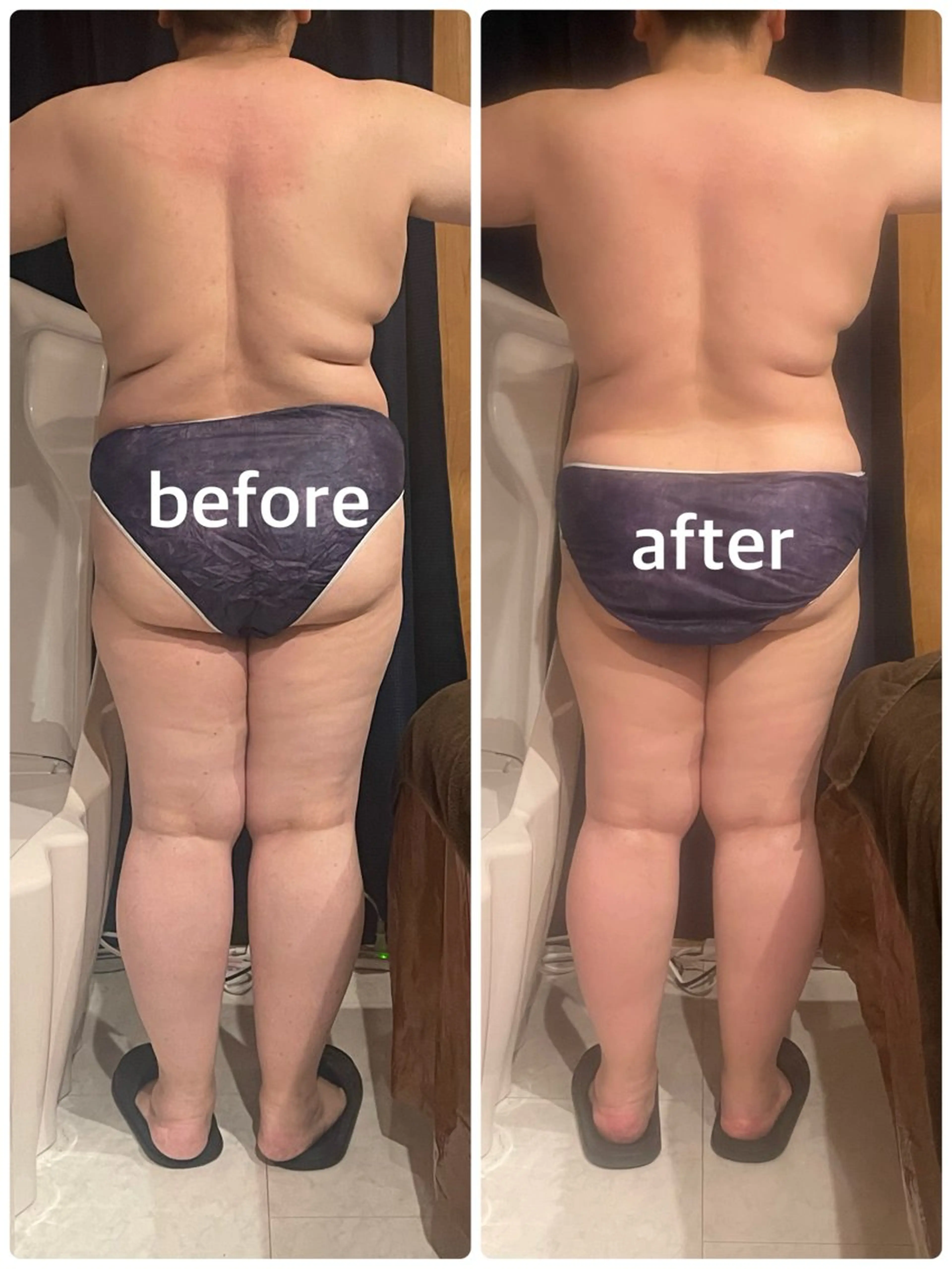 肩凝りの方必見！！老廃物を排出するKONOMI式全身リンパケア120分とおかま直伝よもぎ蒸しのセットの写真