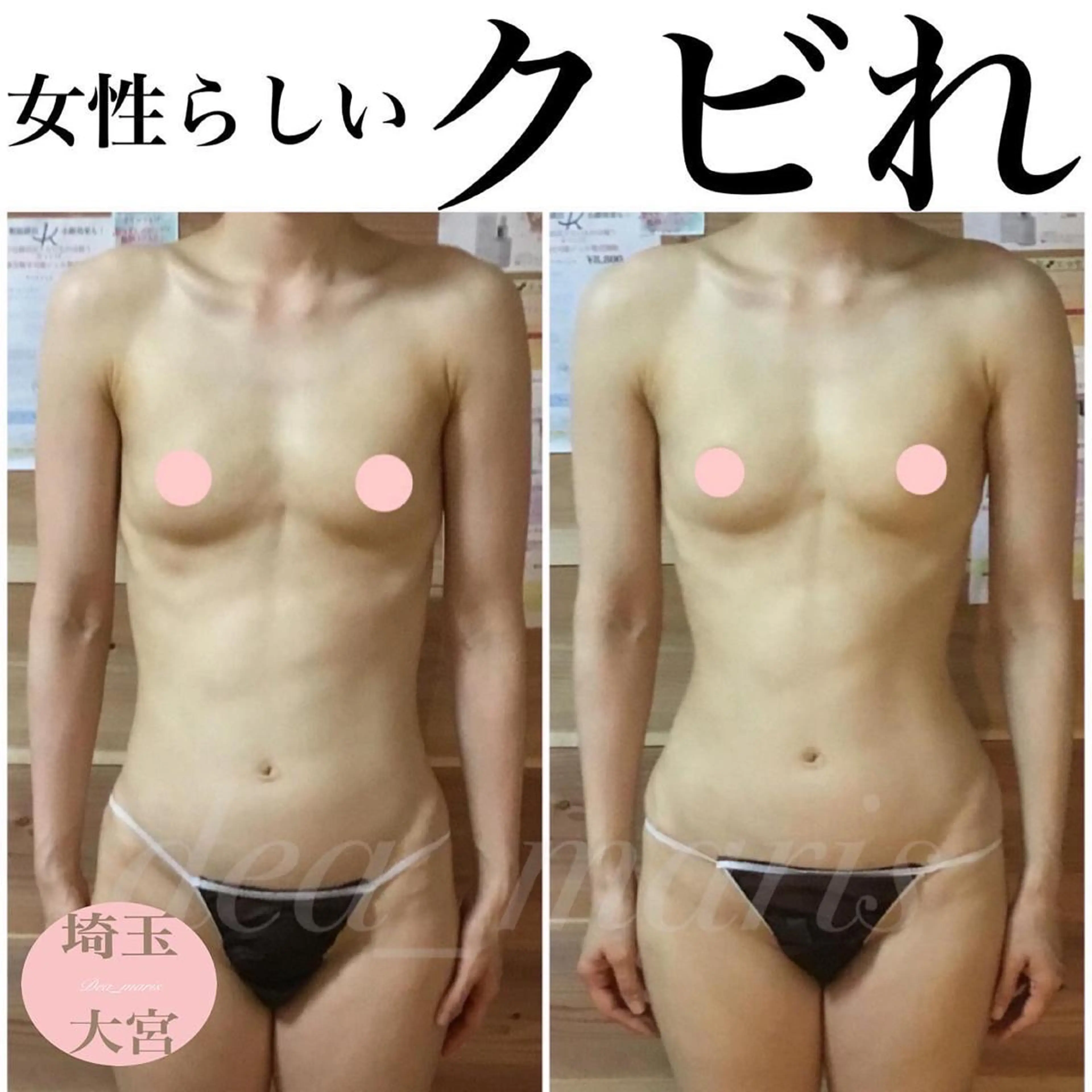 private salon  Dea_maris シュガーリング＆パーソナルボディケア所属・シミ改善・韓国肌管理 ボディメイク痩身のその他イメージ