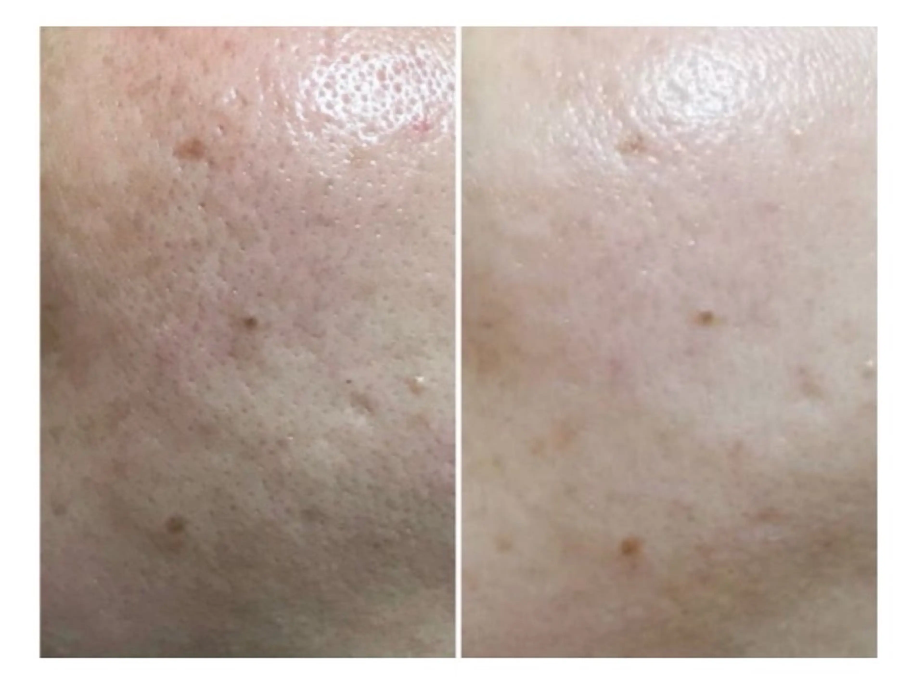 エステサロン lindyのエステ・リラクイメージ