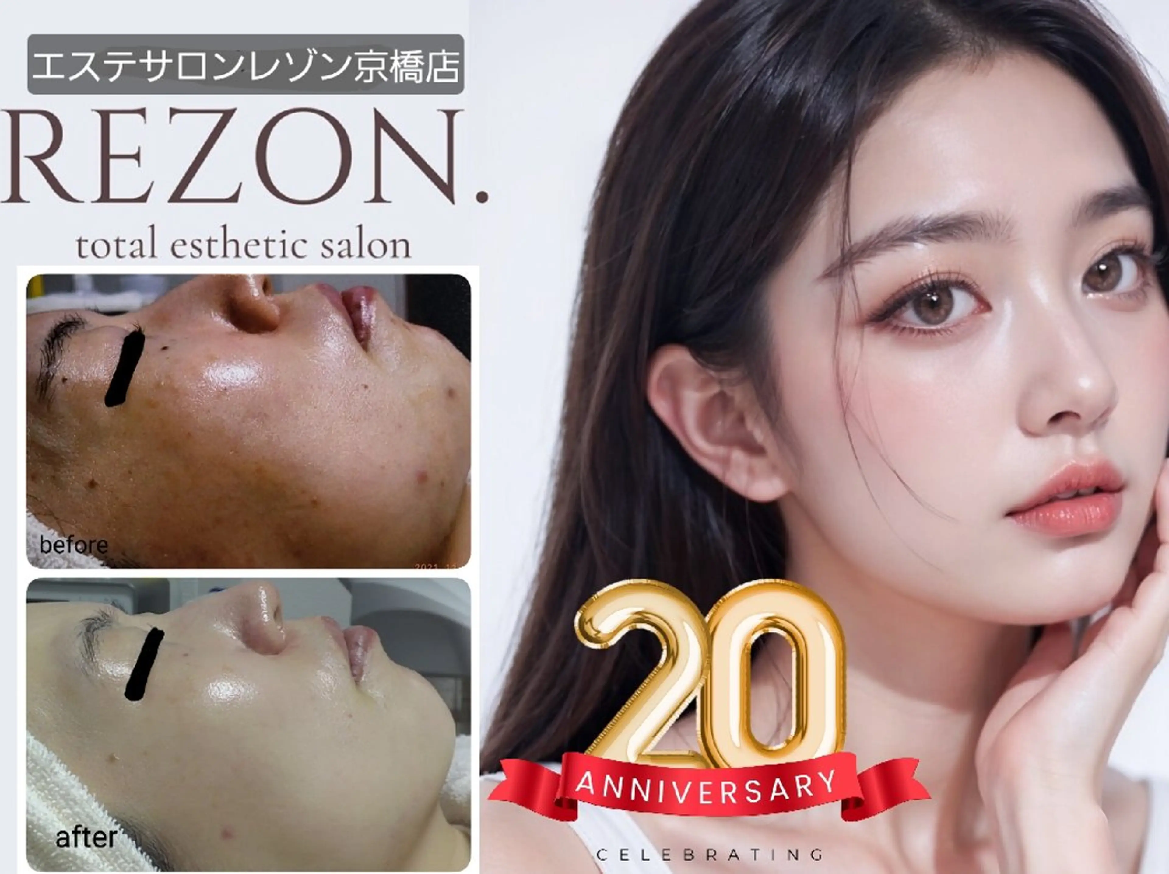 ニキビケア&ニキビ跡 レゾン京橋店 のエステ・リラクイメージ