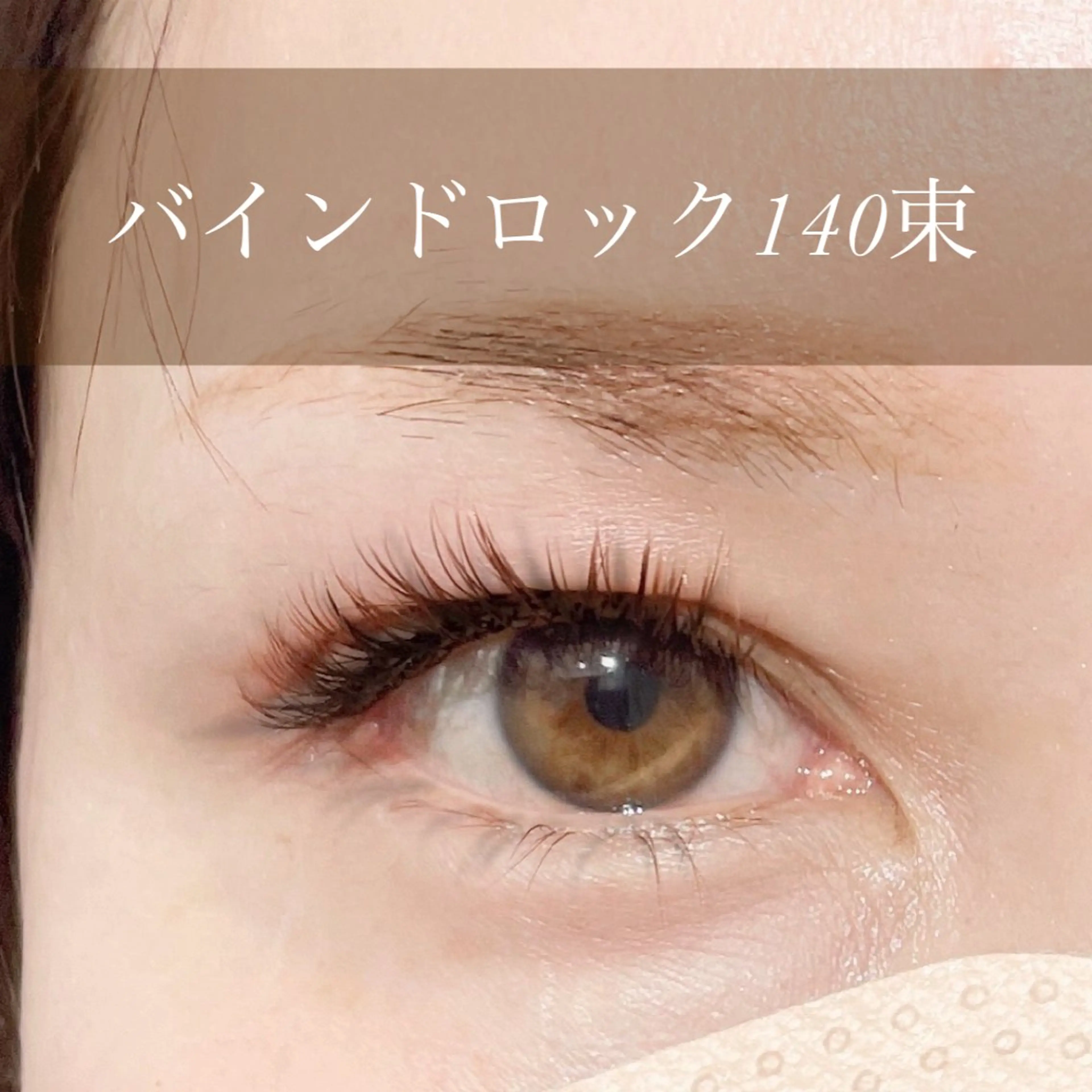 バインドロック140束の写真