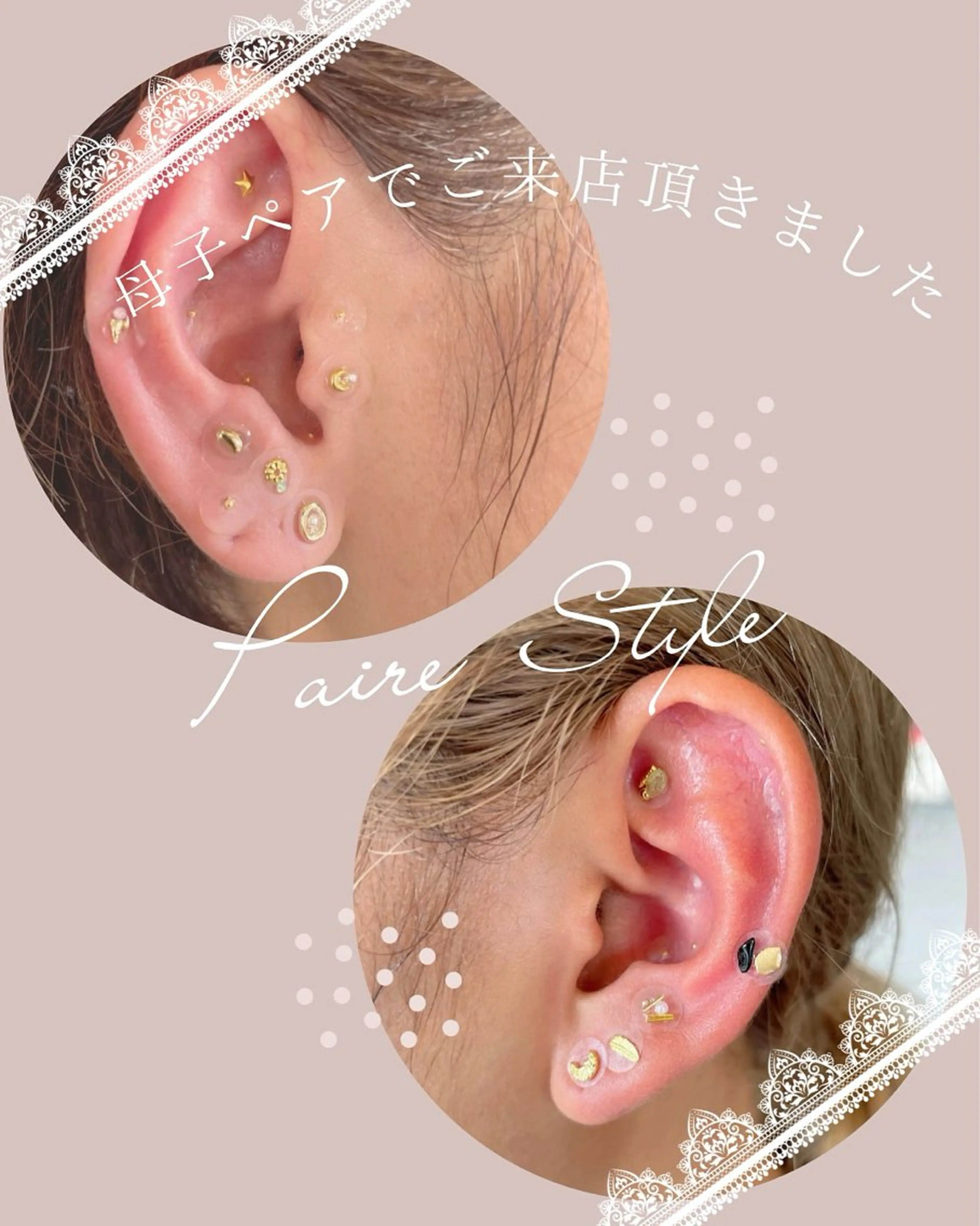 mimine エメラルド式耳つぼのその他イメージ