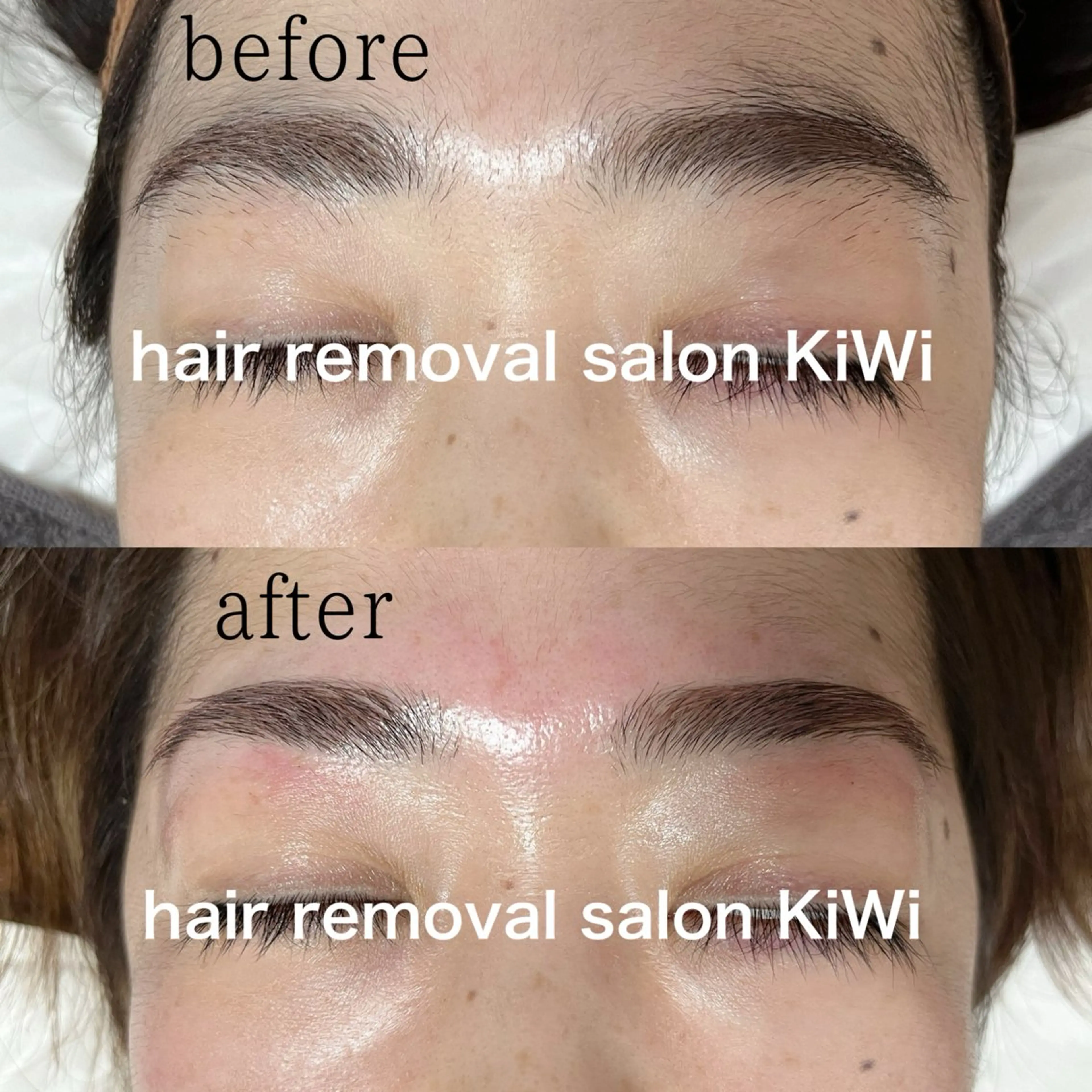 アイブロウ 脱毛サロン KiWiのエステ・リラクイメージ