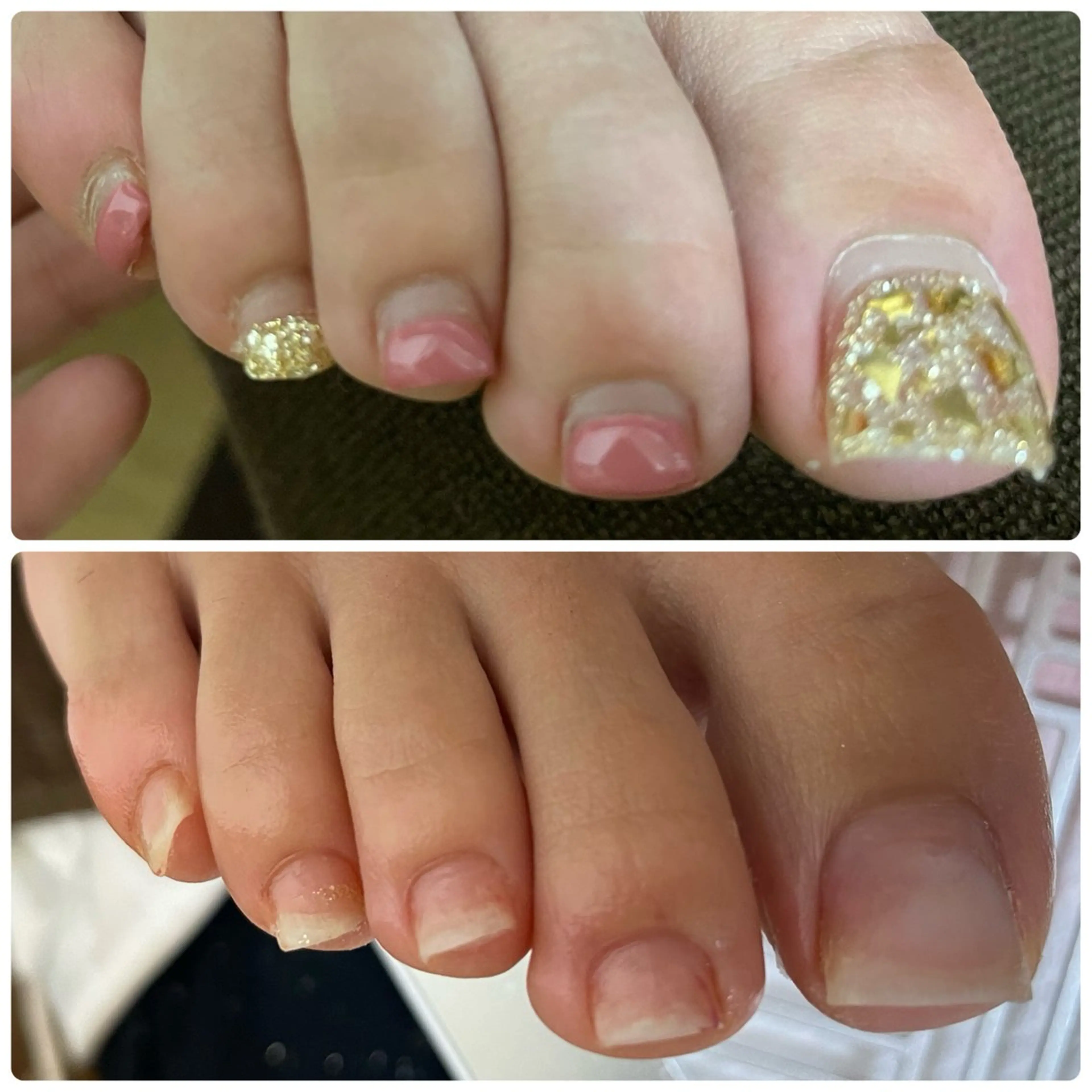 ネイル フットネイル 🔰 新米ネイリストのネイルデザイン