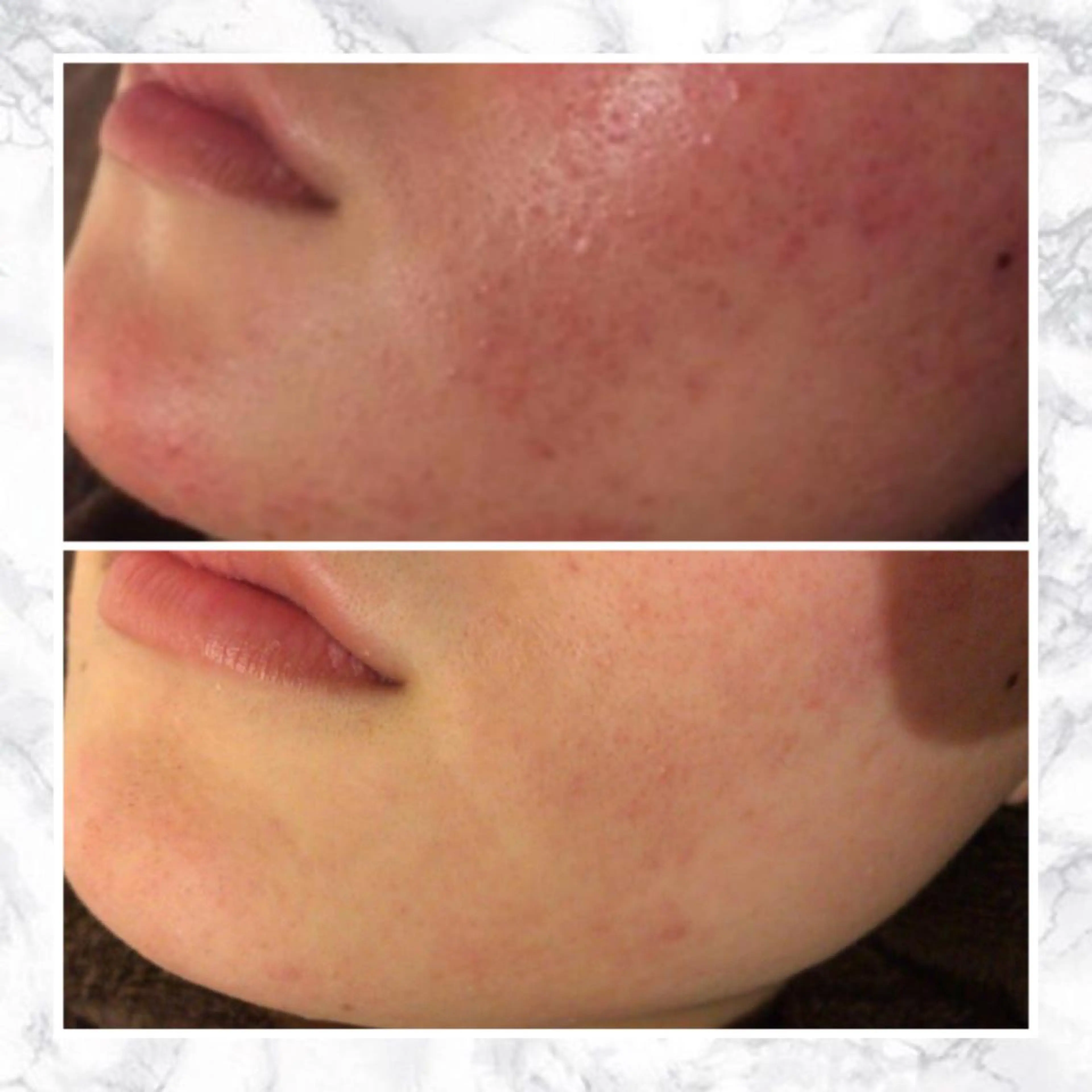 ミディアム カラー パーマ ヘアアレンジ メンズ キッズ ネイル マツエク・マツパ アイブロウ 触れたくなる モテ肌へ...❤︎のエステ・リラクイメージ