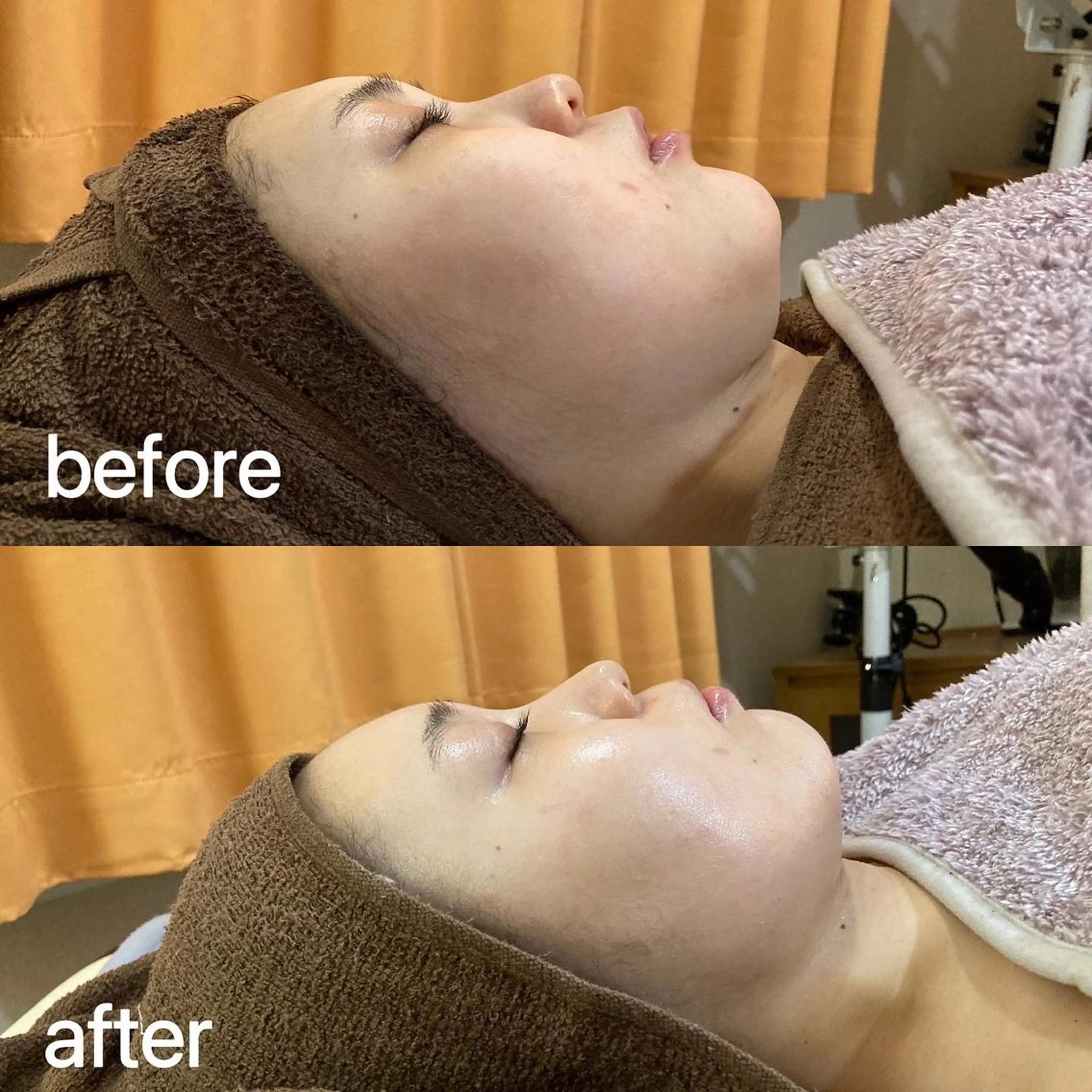 eminy所属・Yuuki 陶肌トリートメントのエステ・リラクイメージ