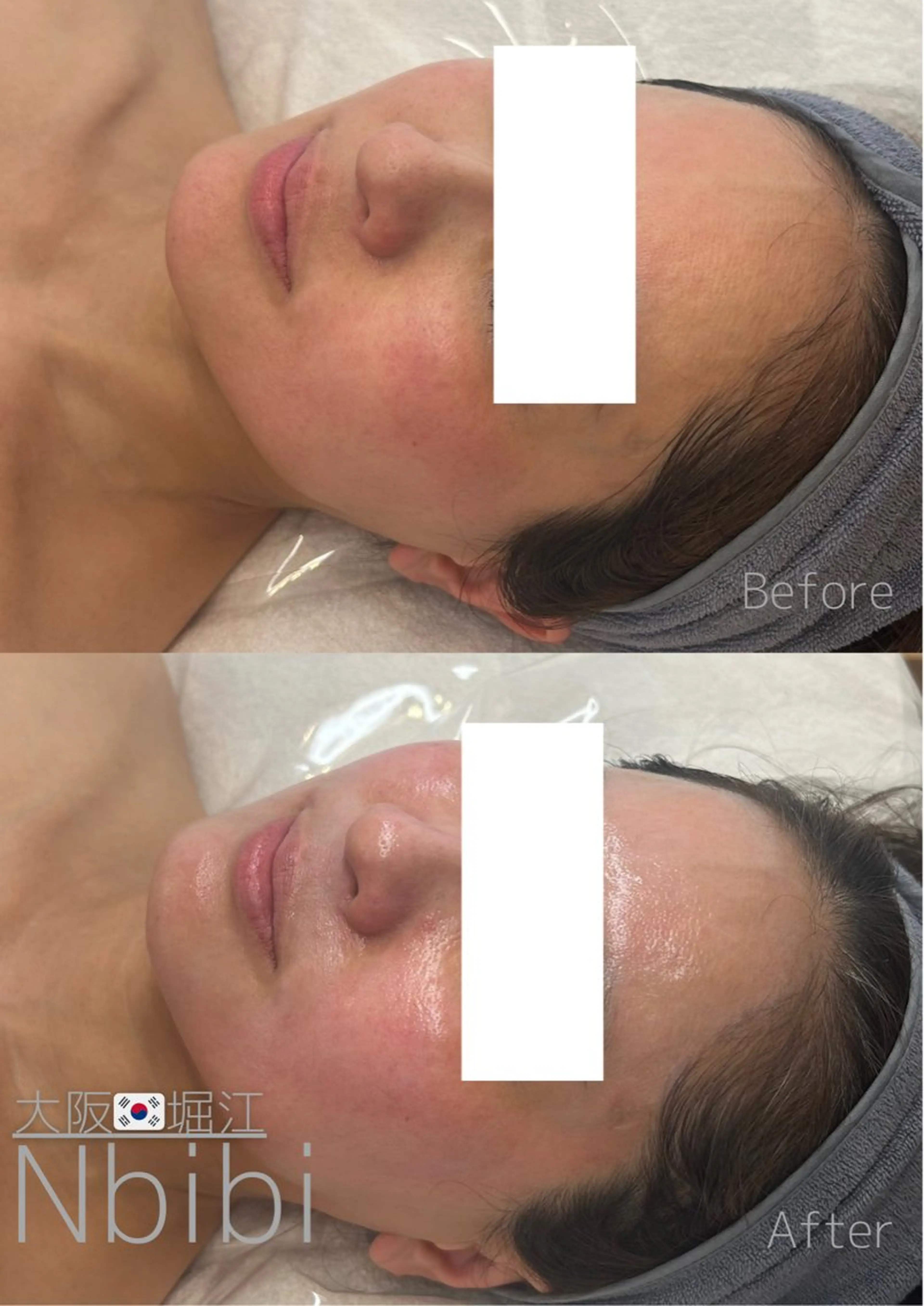 エステ 韓国🇰🇷価格 サロン_Nbibiのエステ・リラクイメージ