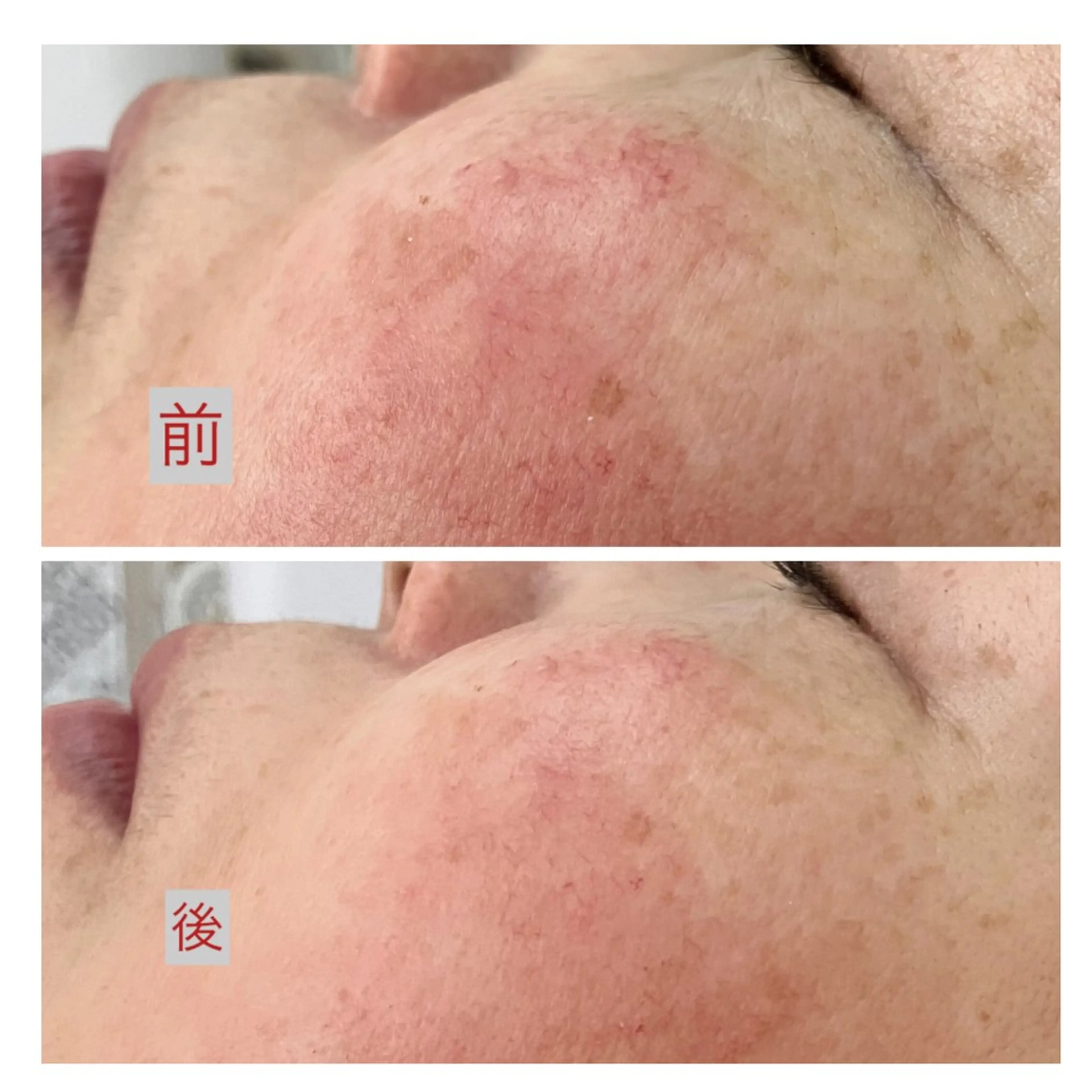 その他 たるみ改善小顔エステ 堀葉月のその他イメージ