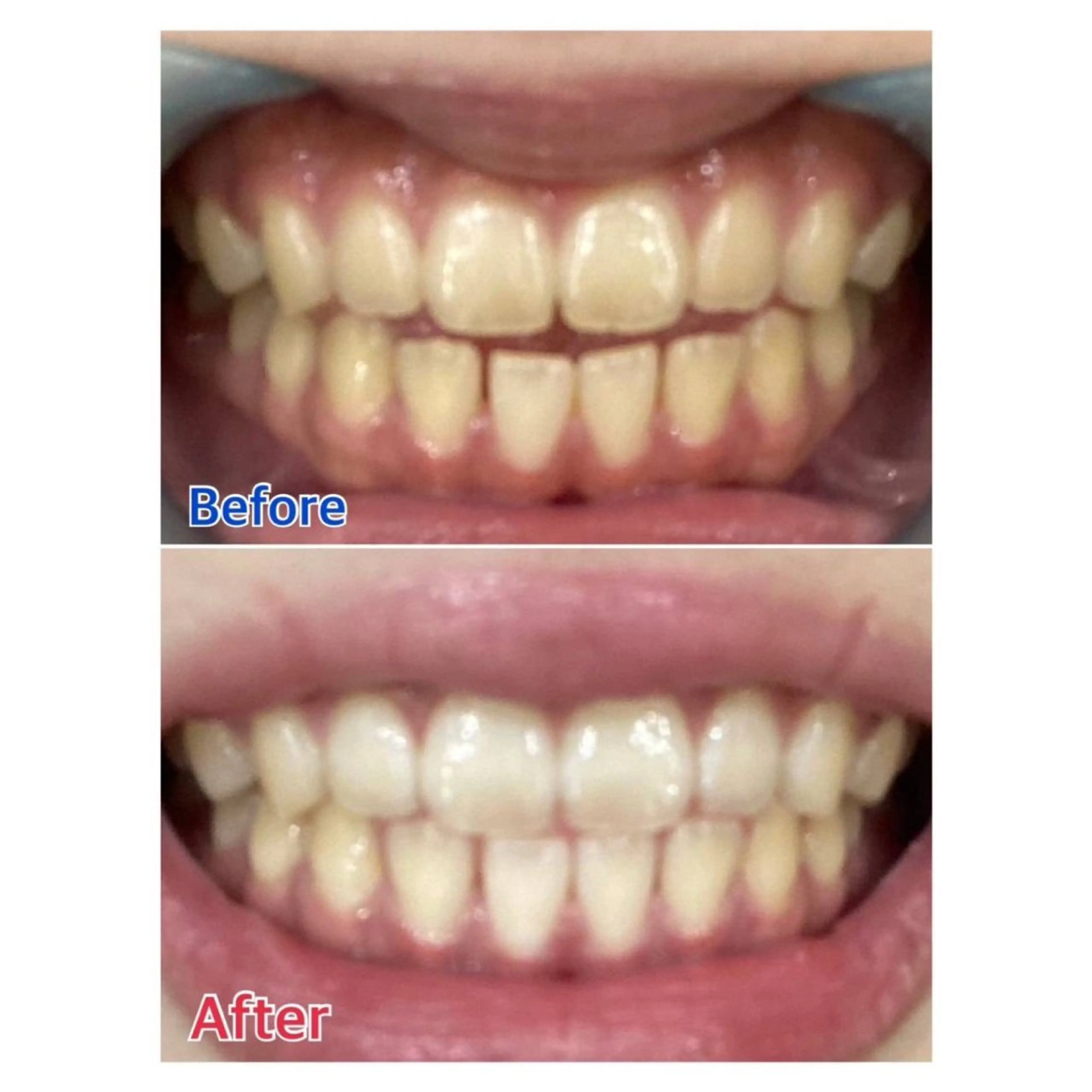 MBEAUTYSALON 千葉店・京成大久保所属・Melty 輝のその他イメージ