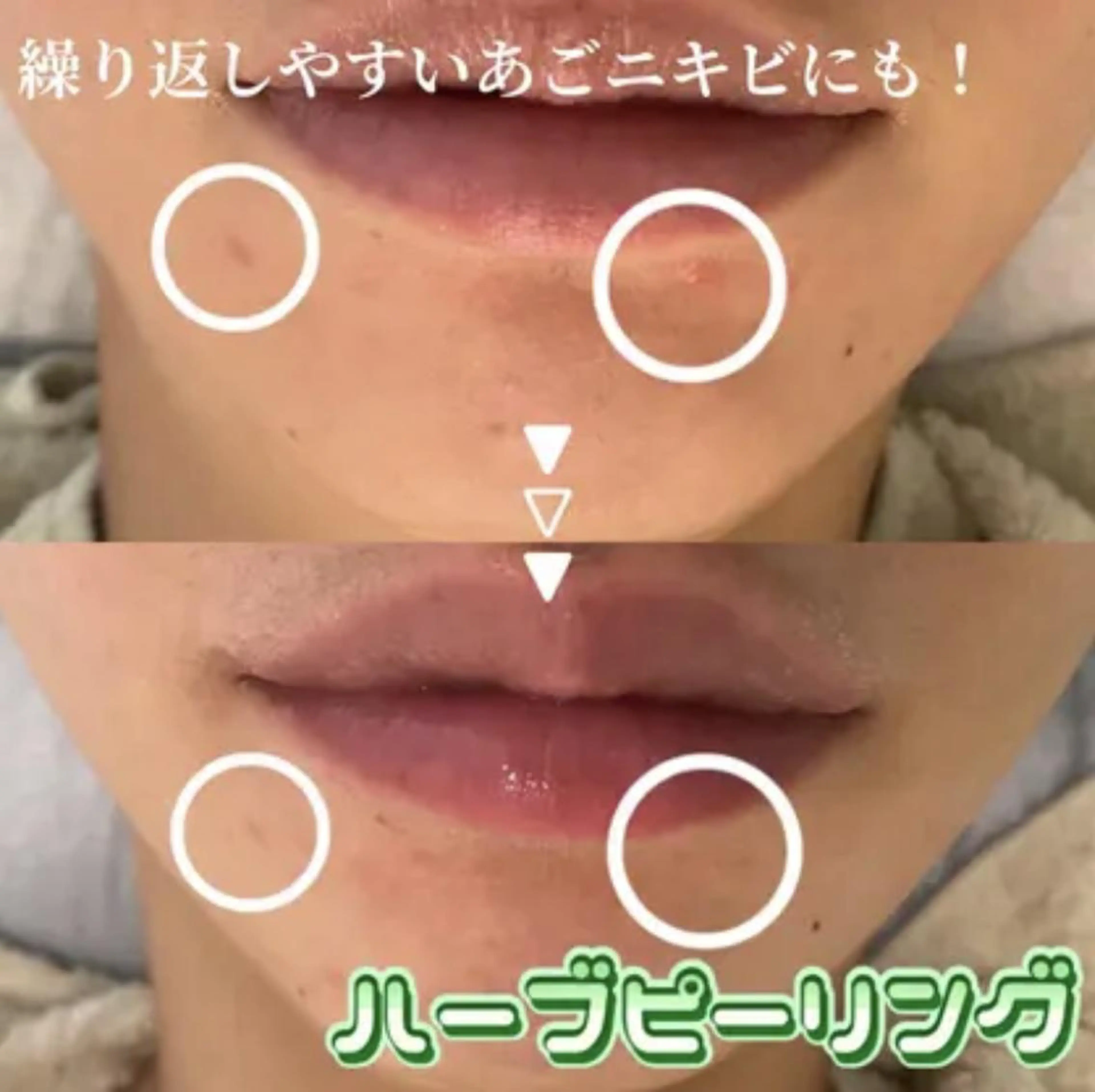 エステ 肌質改善 KALANCHOEのエステ・リラクイメージ