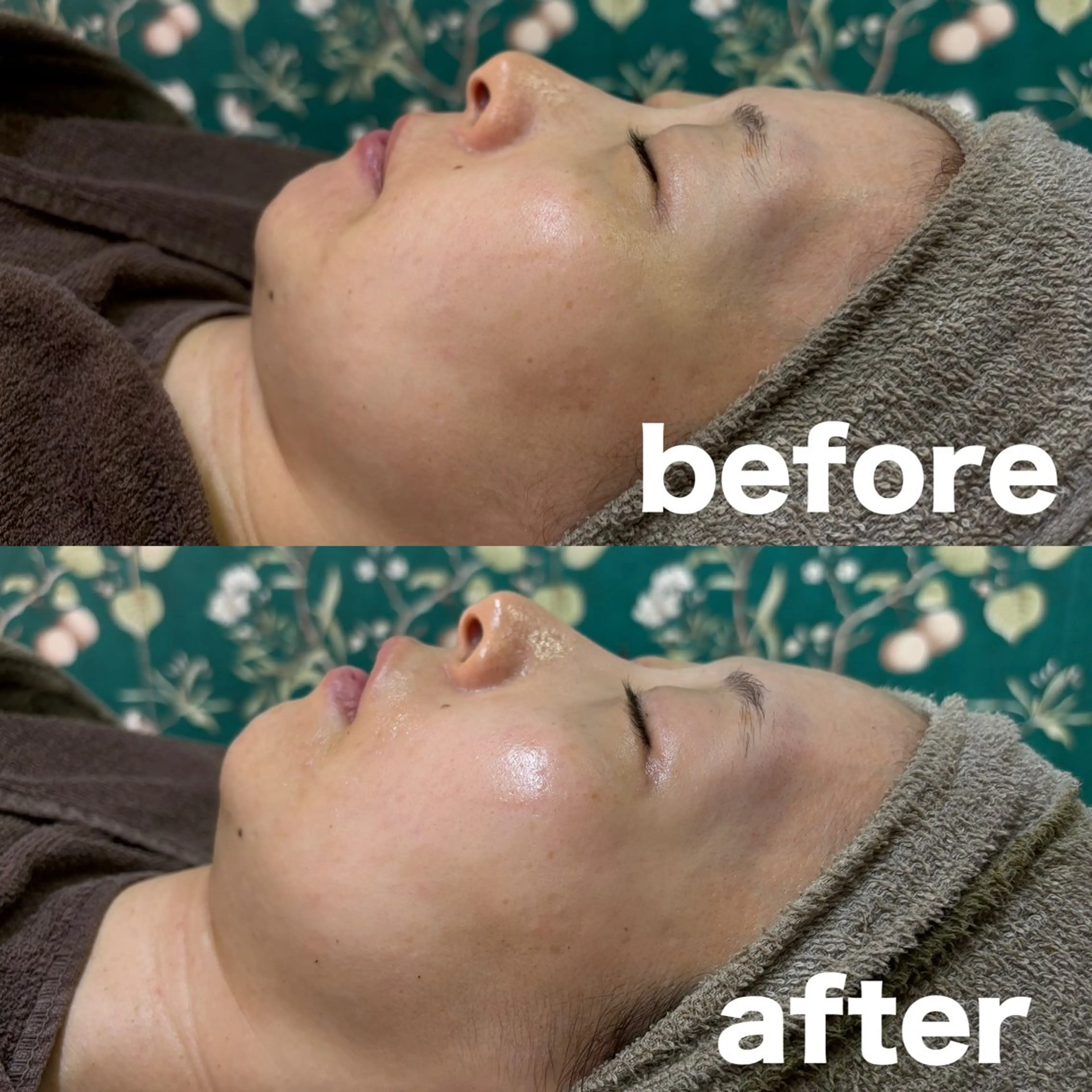 肌質改善 陶器肌🌿のエステ・リラクイメージ