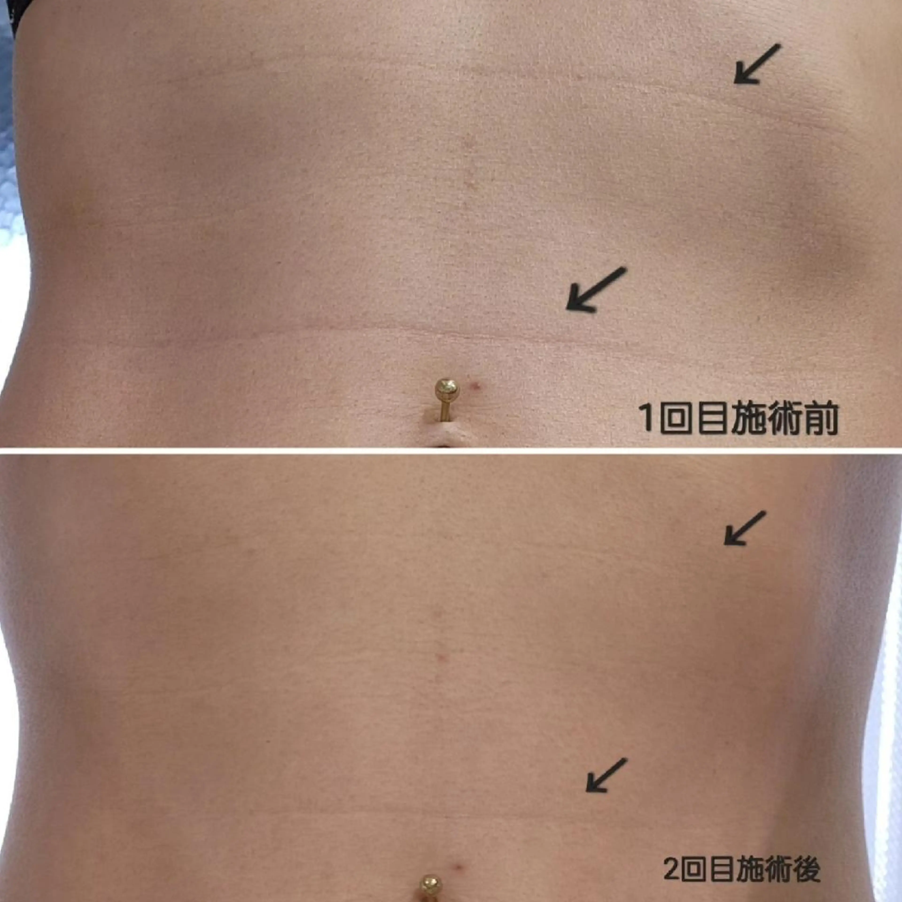 マツエク・マツパ アイブロウ メンズ ネイル Anacia Beauty Salon所属・美肌脱毛&毛穴専門 Anaciaのエステ・リラクイメージ