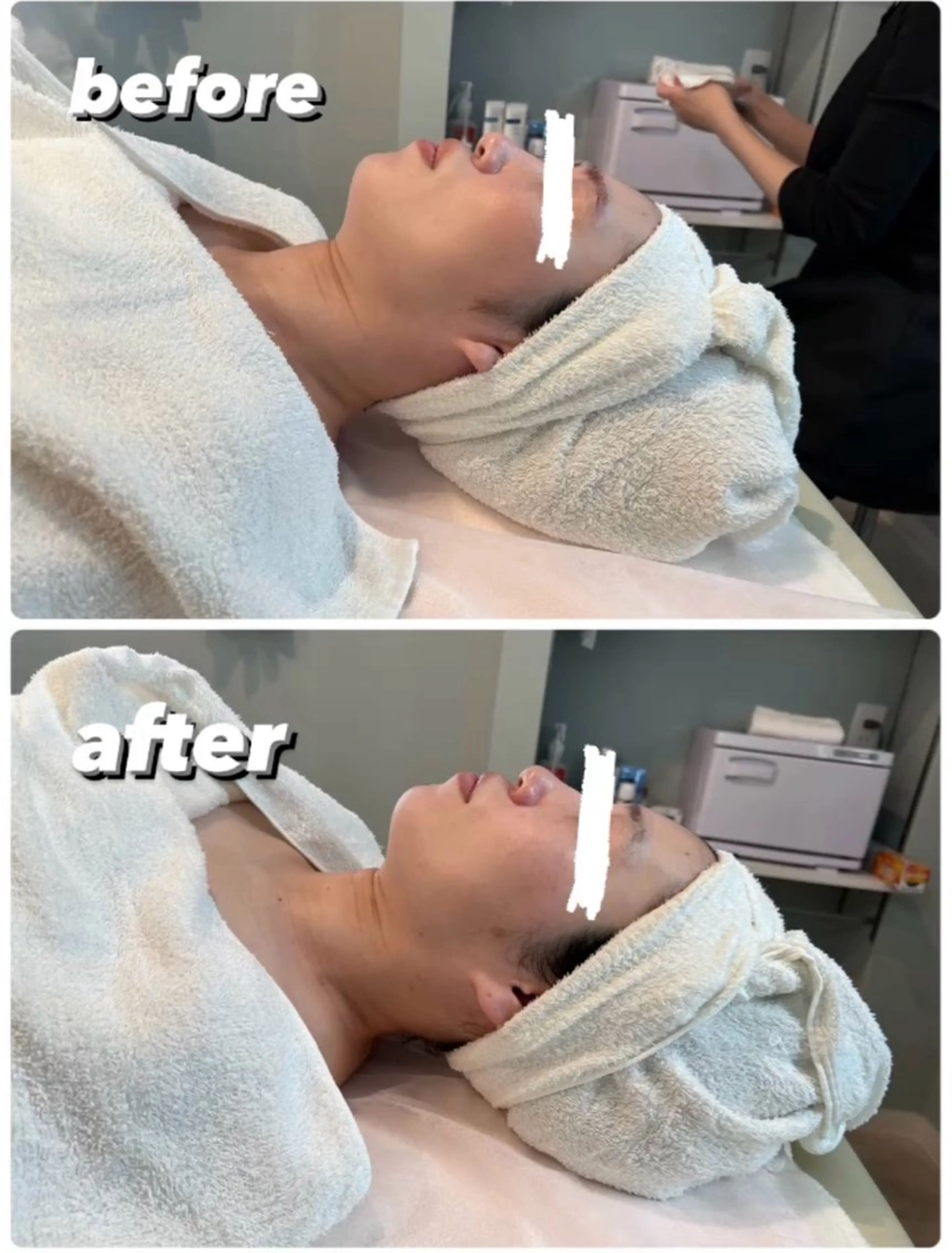 👃毛穴、たるみ引き締め温感石膏マスクエステ💆‍♀️モニター様特別価格💆‍♀️💖の写真