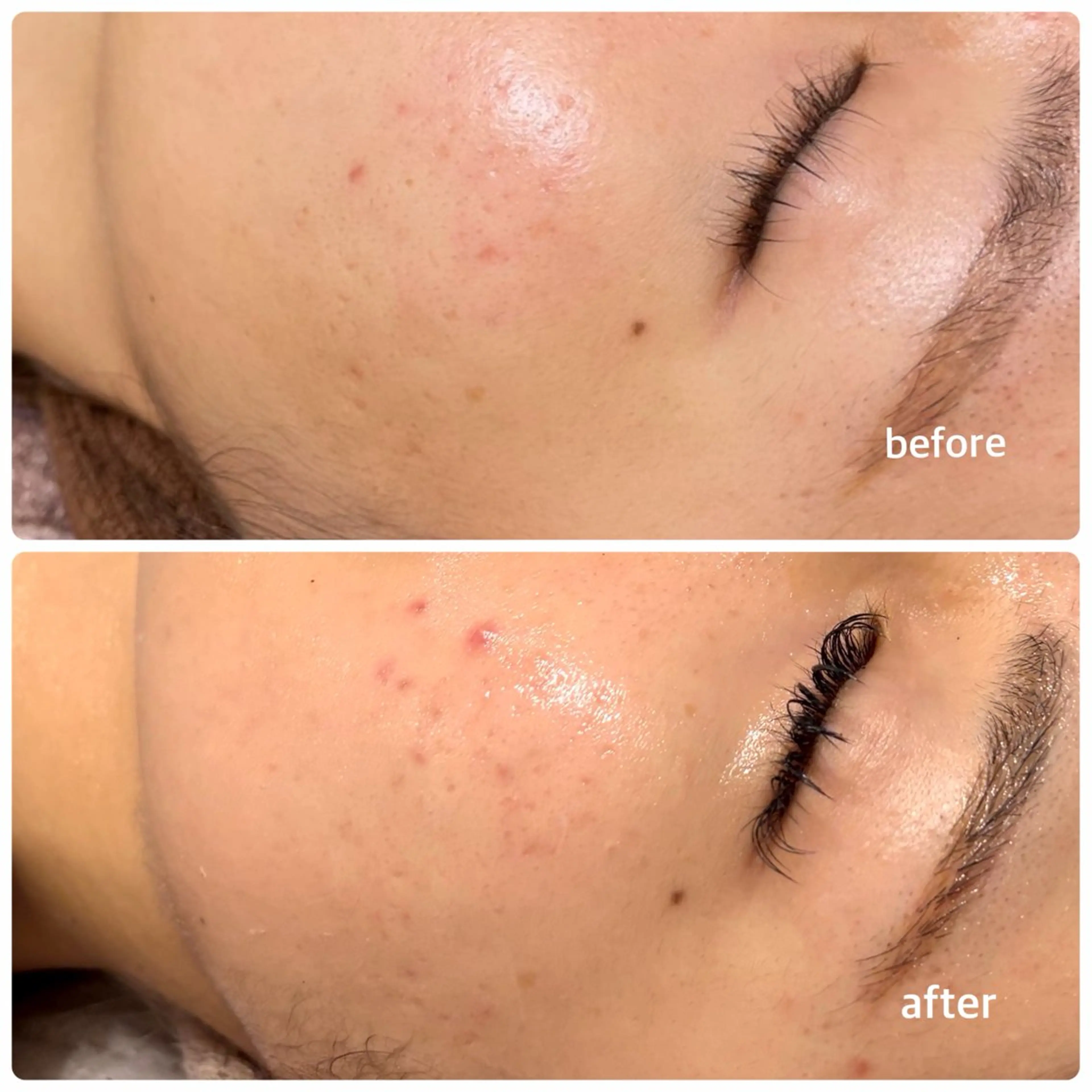 今西 彩夢 Minou心斎橋店のエステ・リラクイメージ